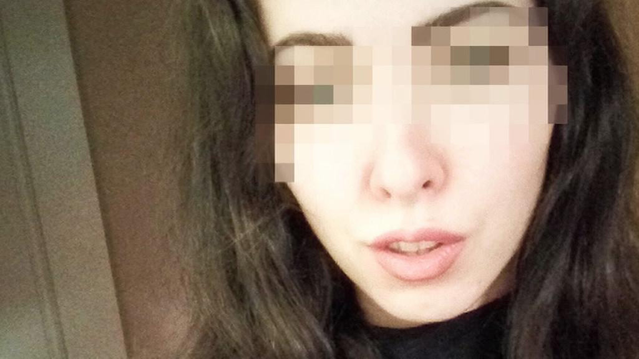 В Волгограде во время пластической операции скончалась девушка