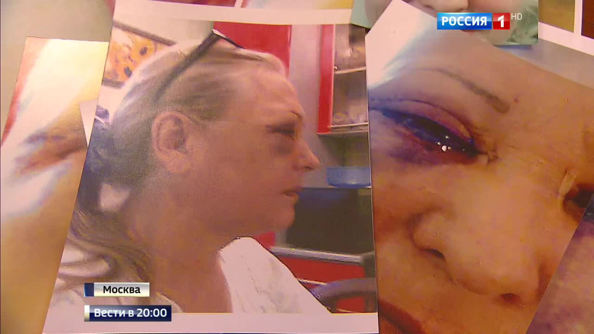 Кем убиты медсестры в Алеппо: Красный Крест равнодушен к смерти своих коллег