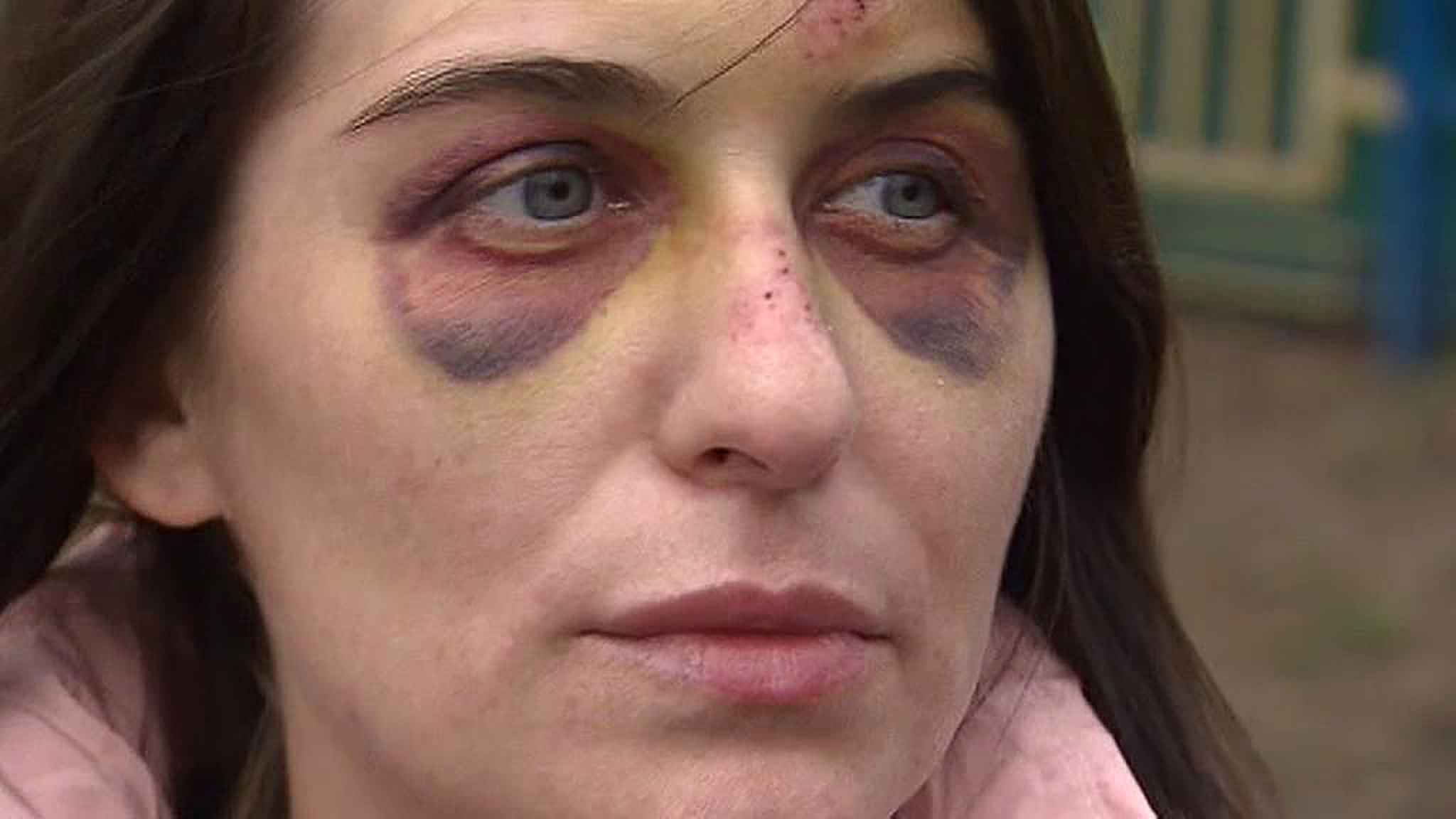 Полиция ищет таксиста, зверски избившего пассажирку
