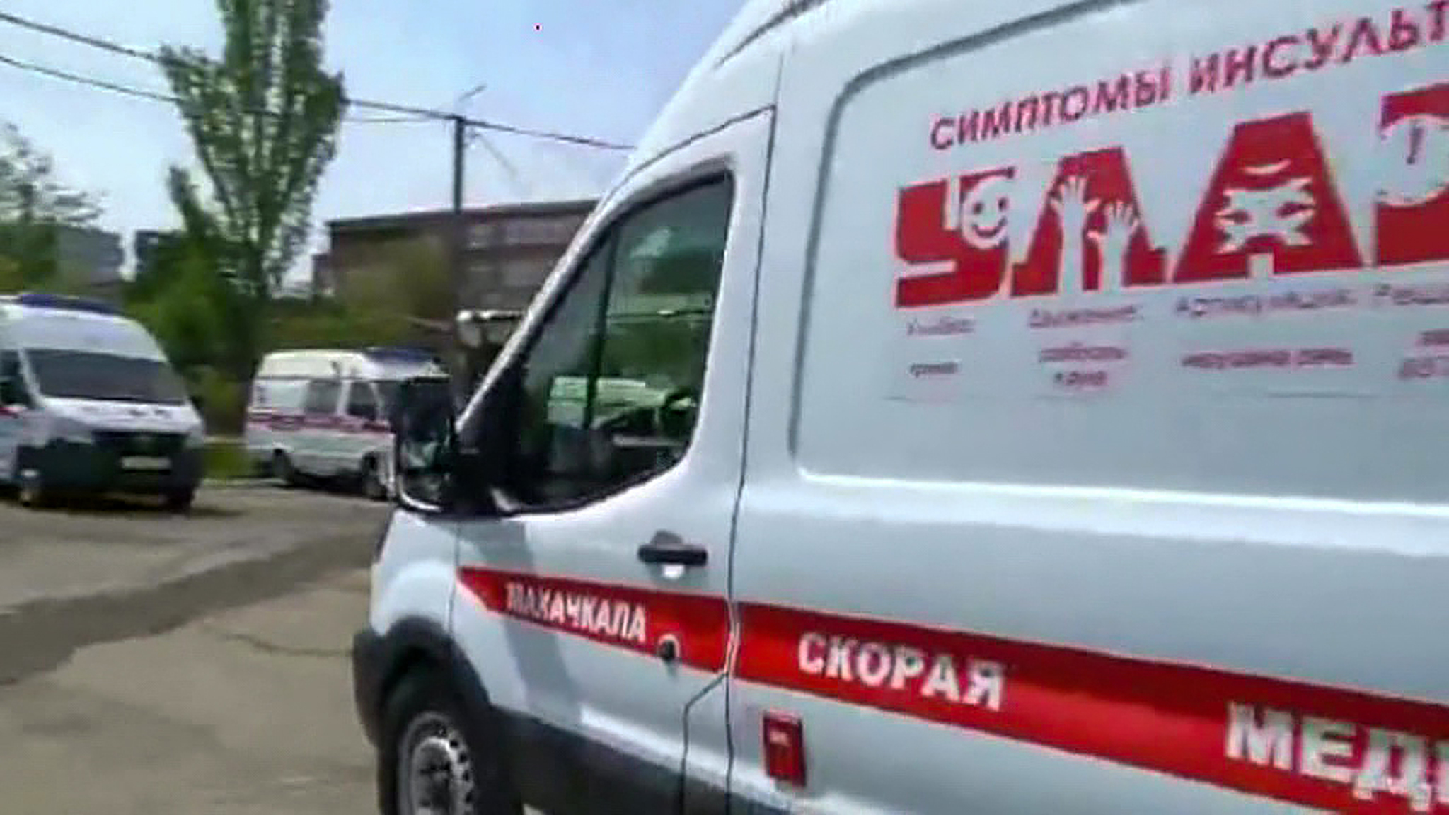 Пострадавший при пожаре в гостинице в Хасавюрте получил ожоги ста процентов тела