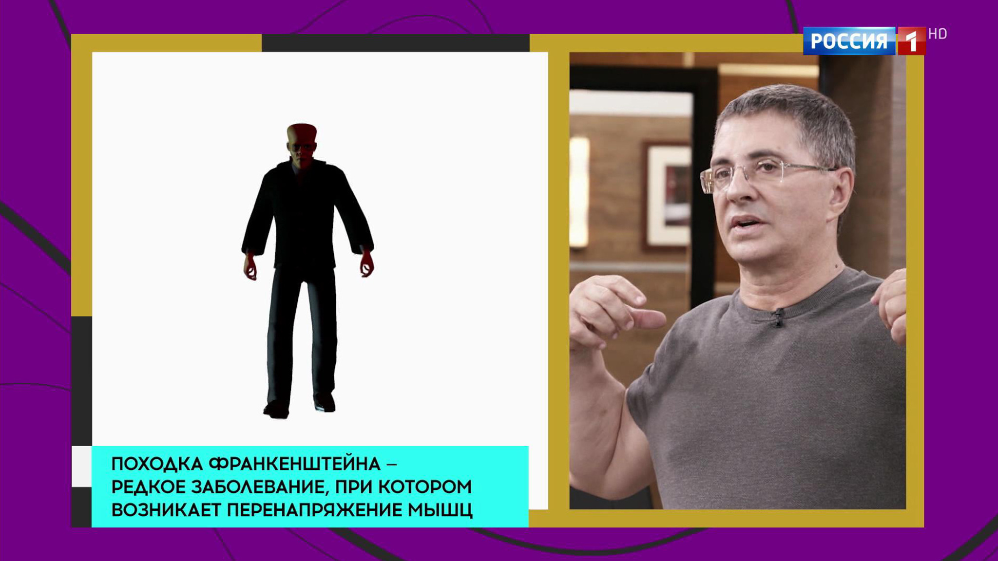 Мясников рассказал, как по походке определить "болезнь Франкенштейна"