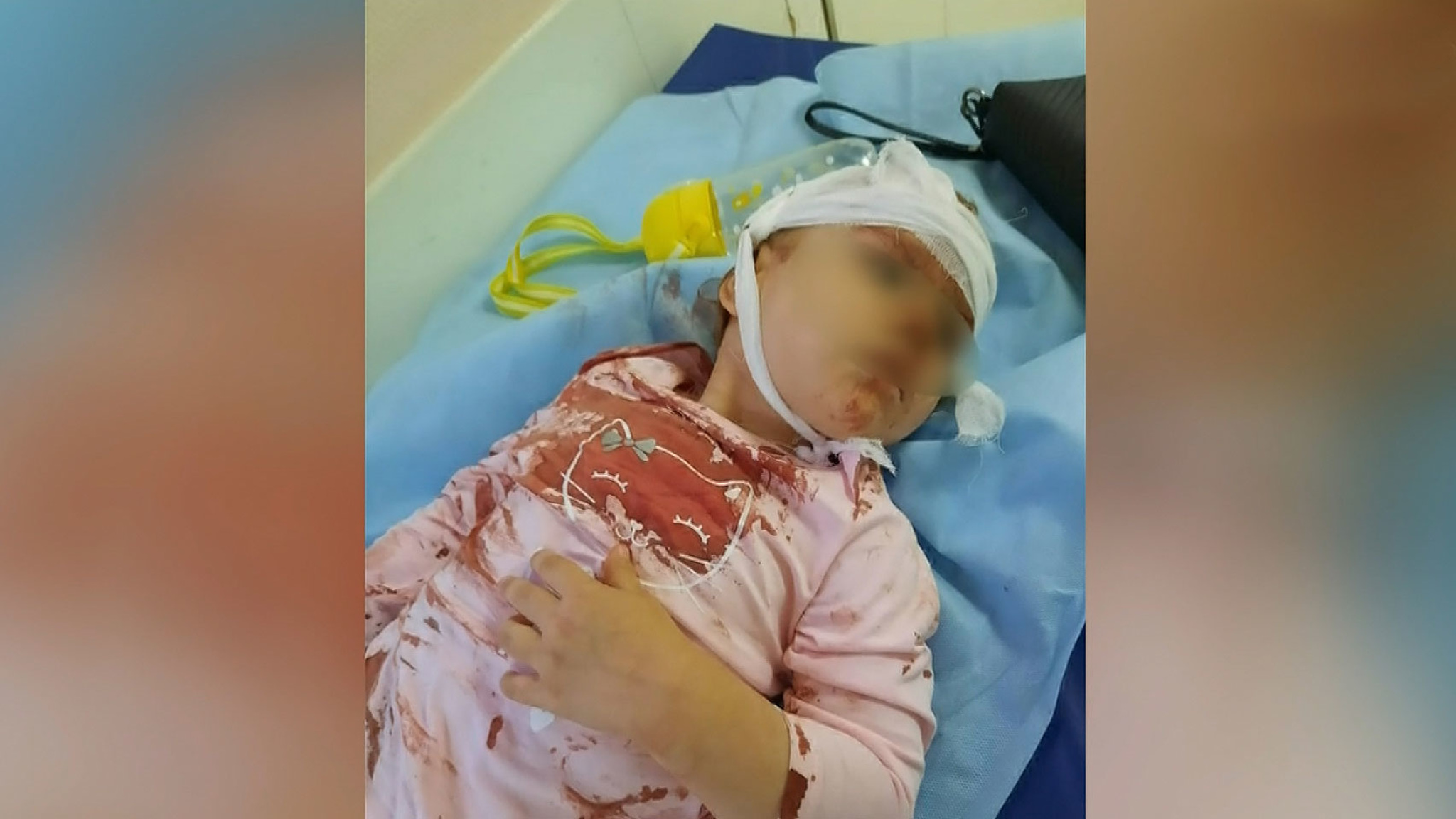 Подростки чуть не убили ребенка, кинув с балкона кусок плитки