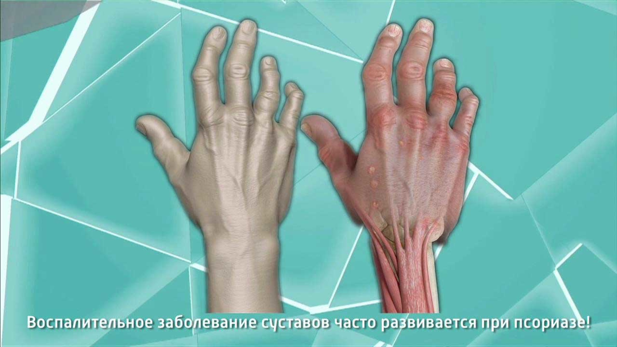 Доктор Мясников назвал необычные симптомы обычных болезней
