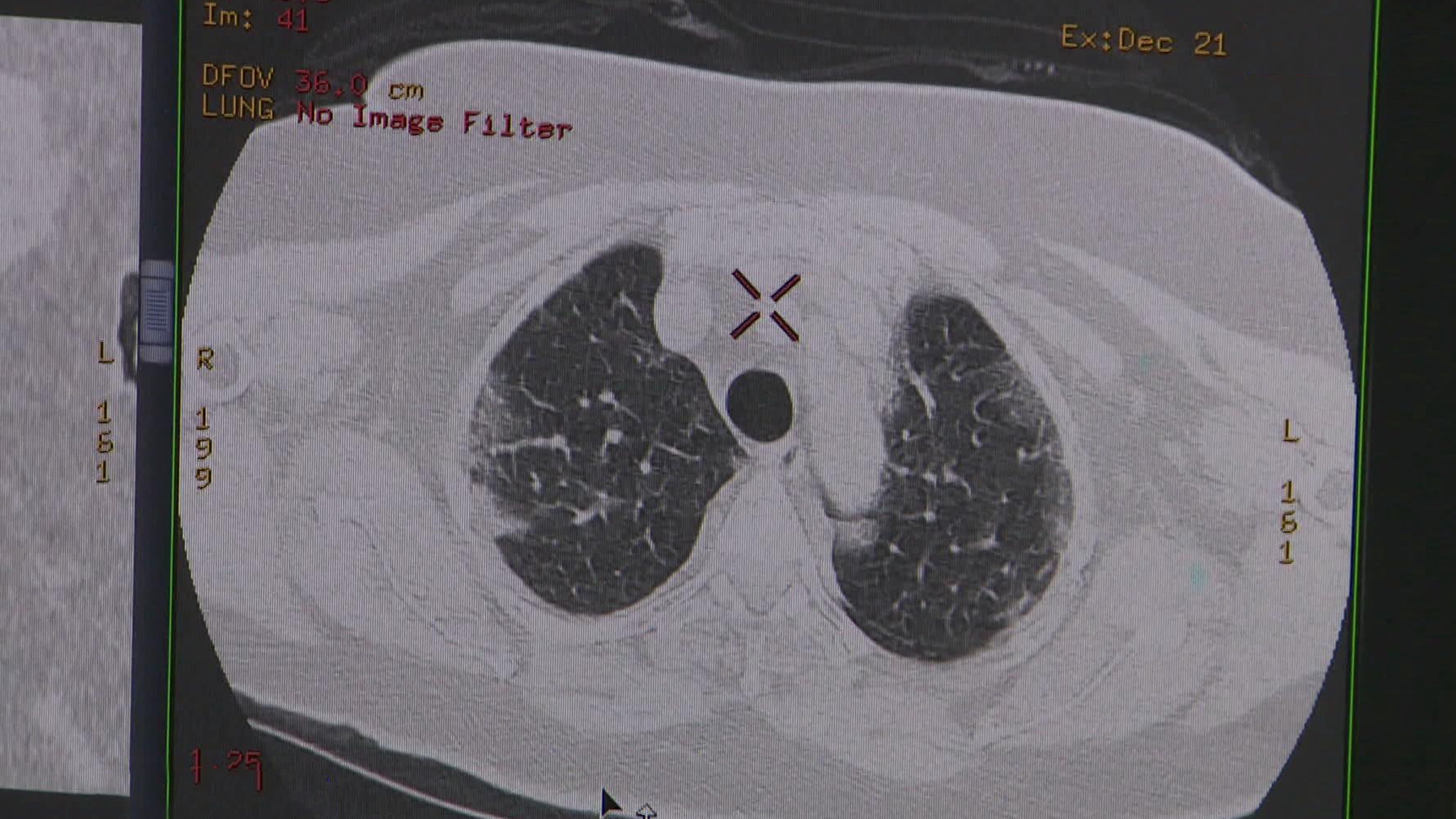 В России за сутки диагностировали коронавирус еще у 22 850 человек