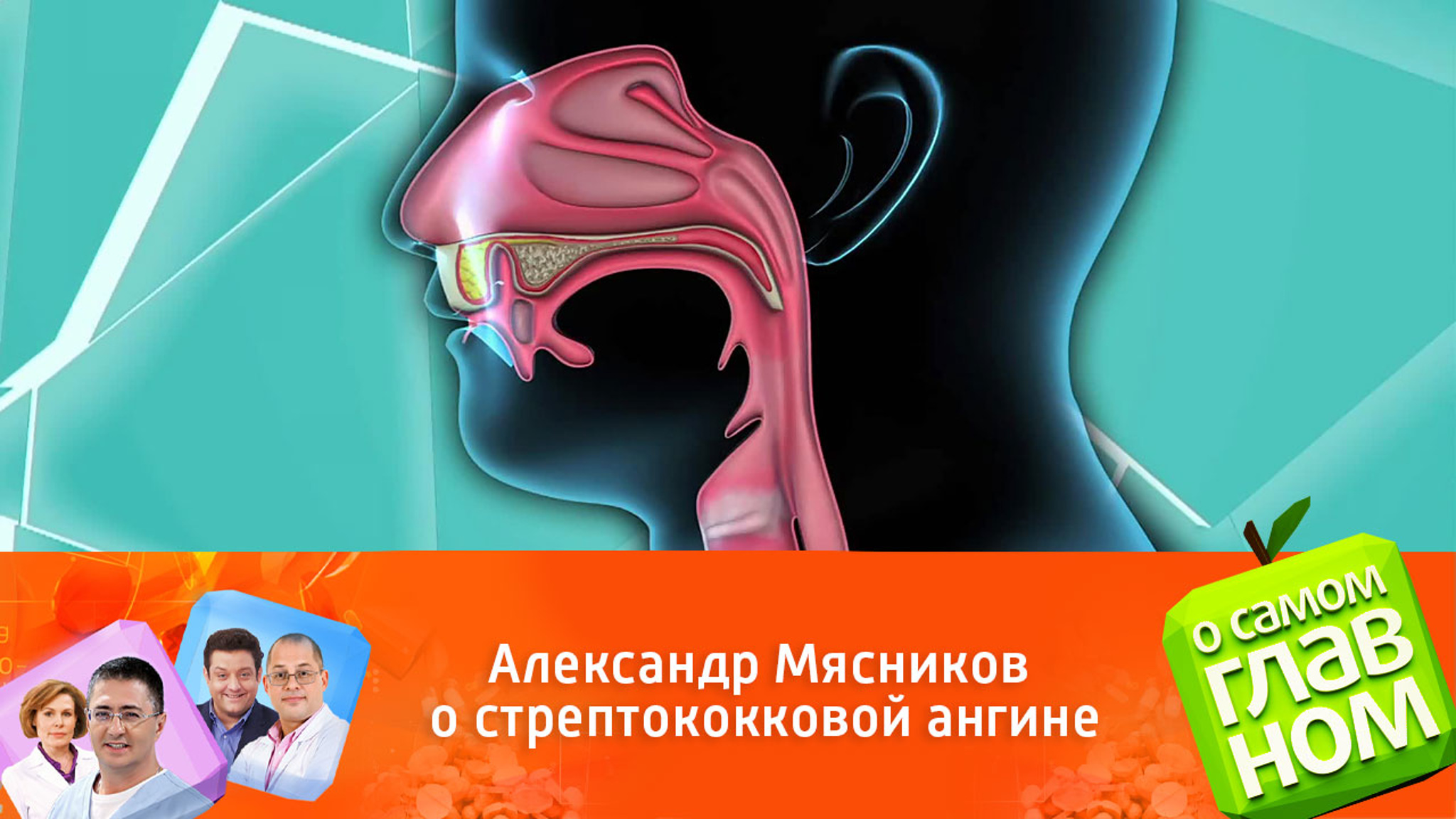 Александр Мясников о стрептококковой ангине
