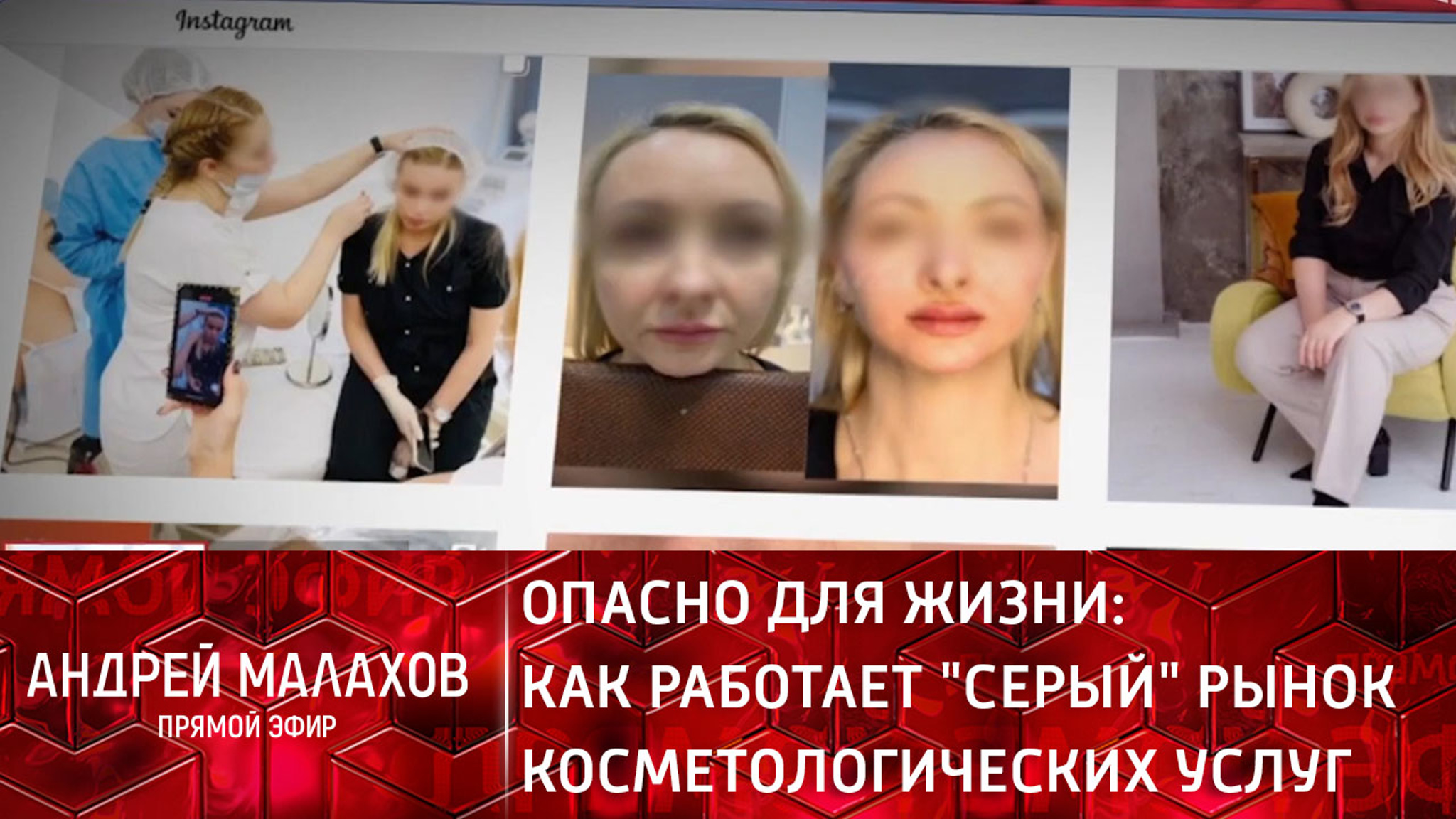 Опасно для жизни: как работает "серый" рынок косметологических услуг