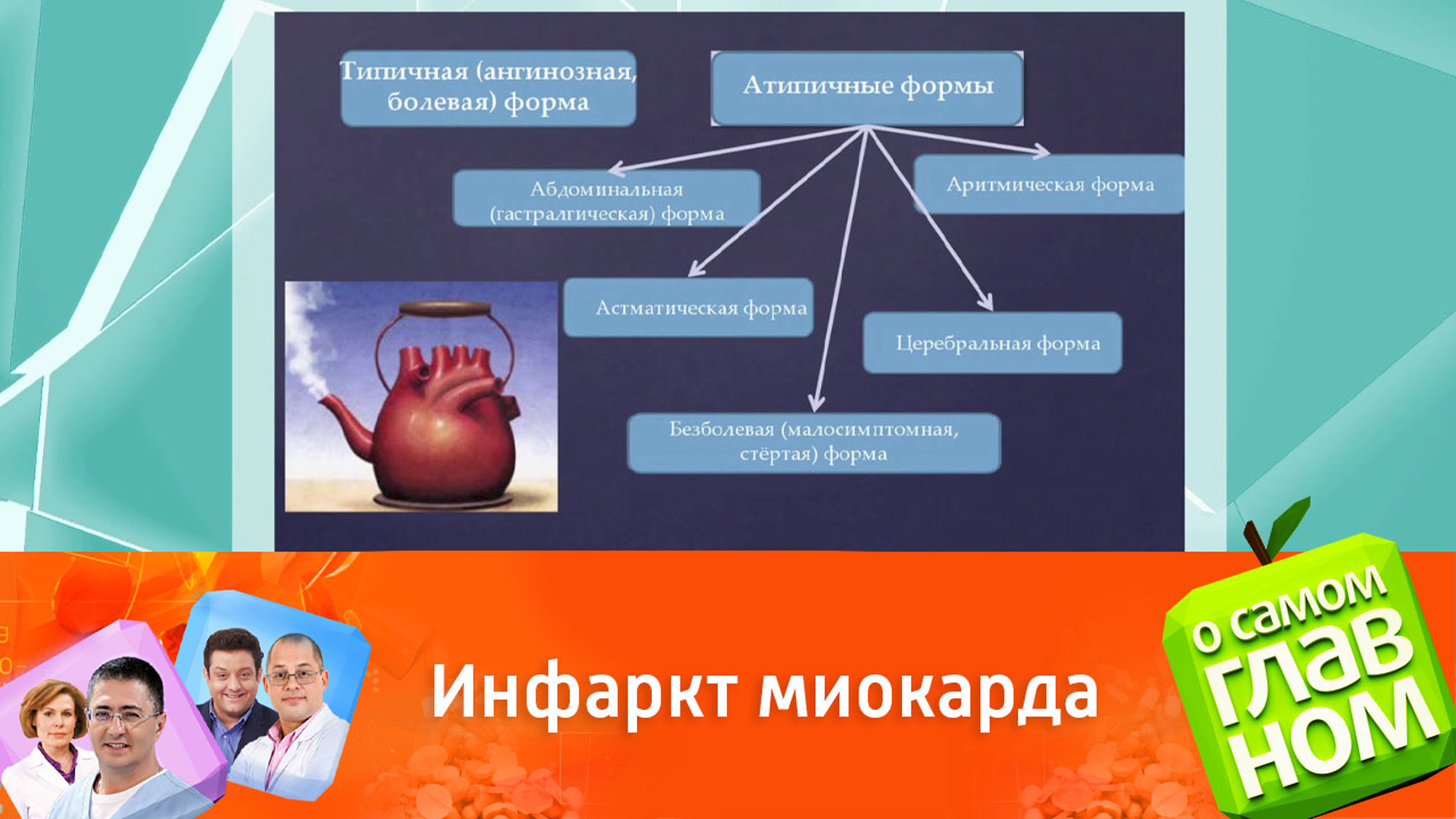 Под какими масками может скрываться инфаркт миокарда