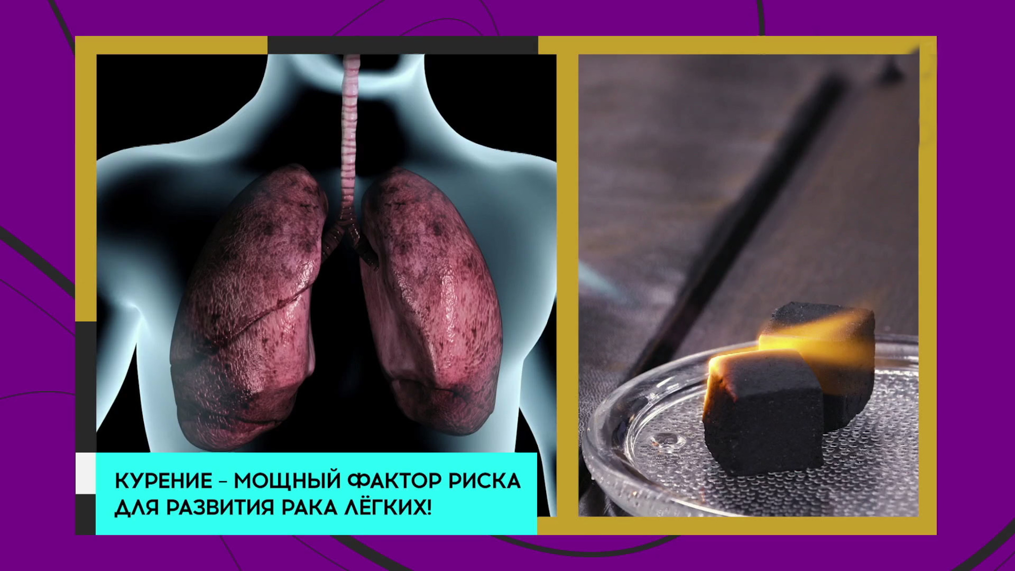 Доктор Мясников: кальян вреднее сигарет