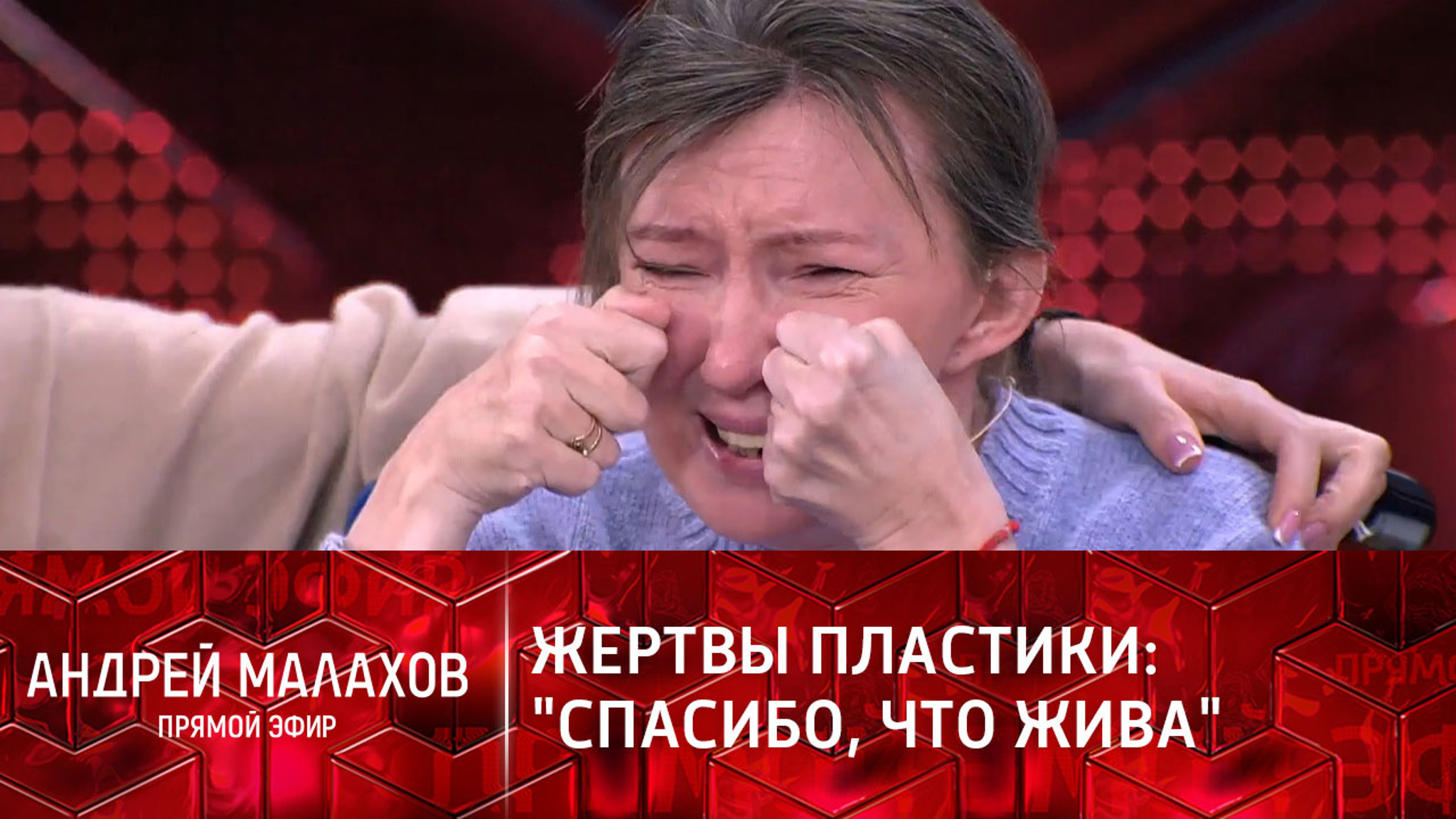 "Спасибо, что жива": три жутких примера неудачной пластики