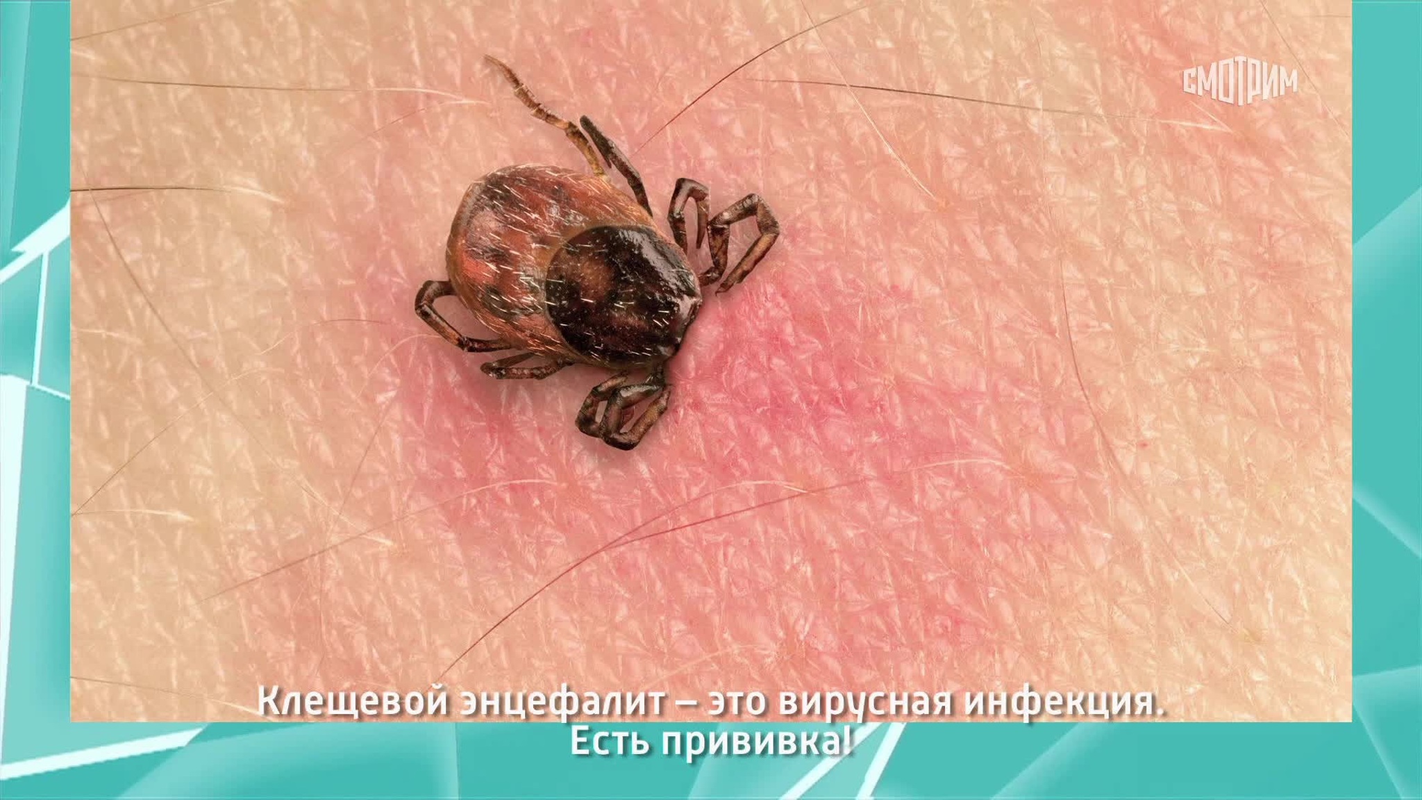 "Может проявиться зимой": доктор Мясников об укусе клеща