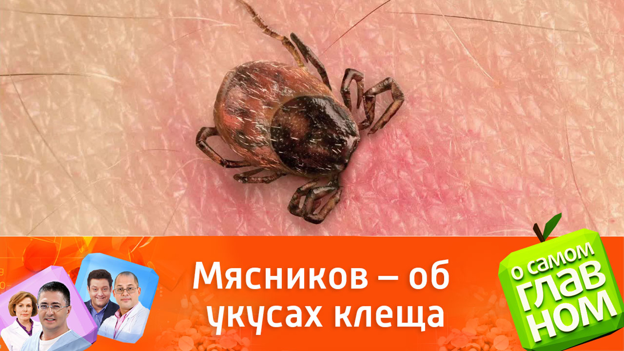 Мясников: "Укус клеща может проявиться зимой"