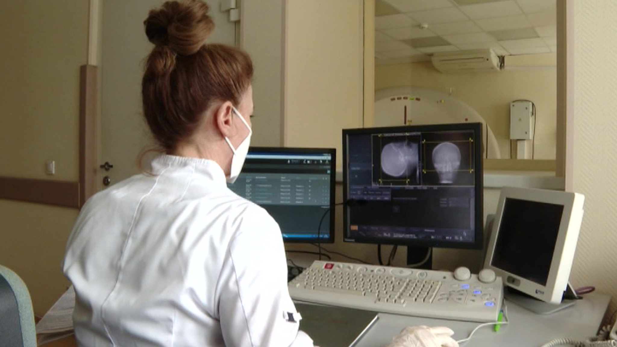 Число новых случаев COVID-19 в РФ за месяц оказалось ниже 400 тысяч
