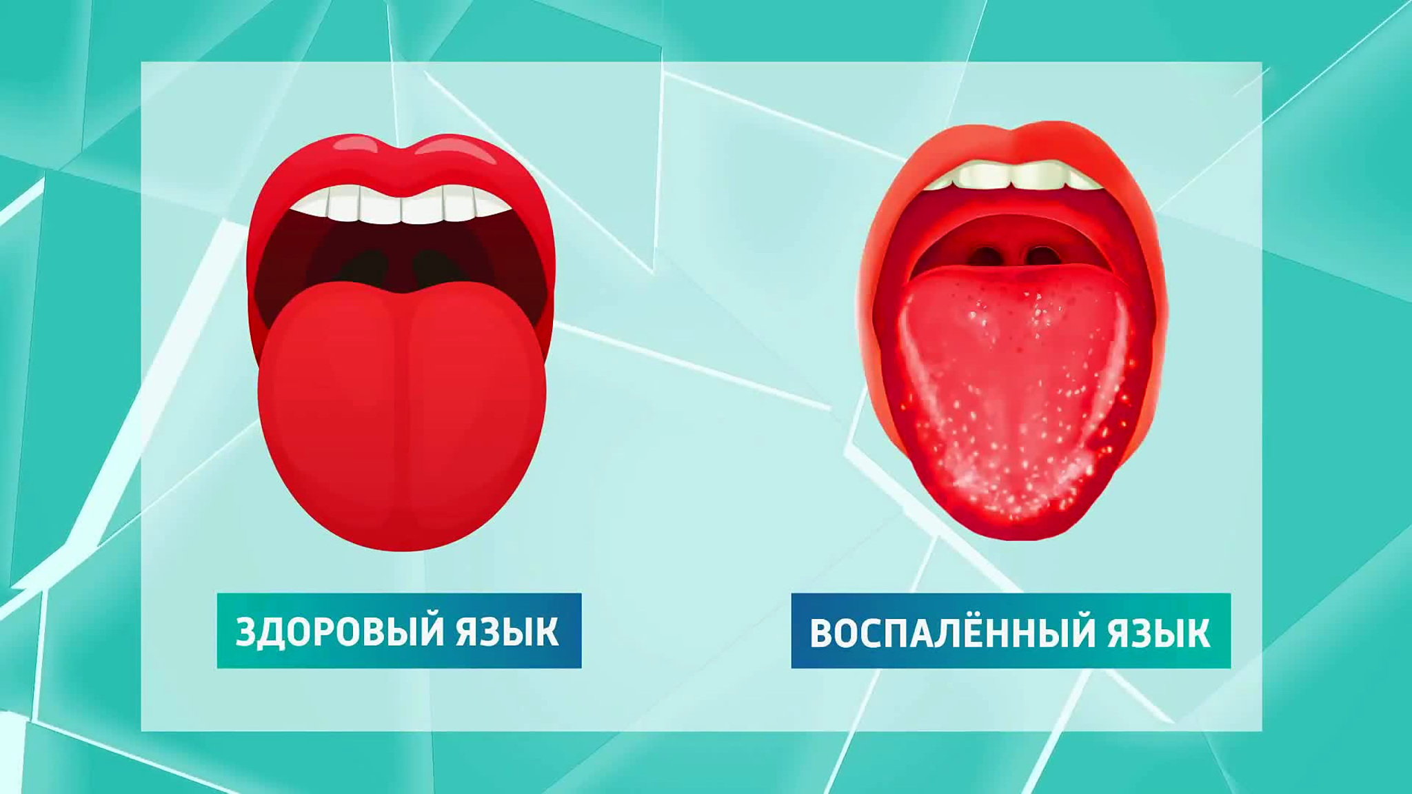 О каких заболеваниях язык расскажет без слов