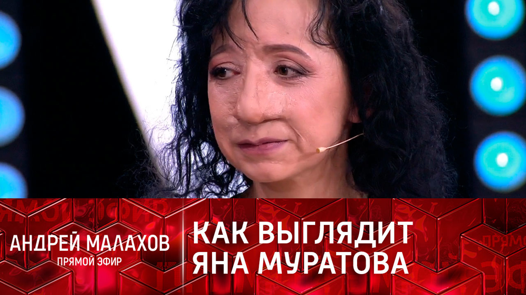 Как выглядит Яна Муратова, пережившая 19 операций на носу