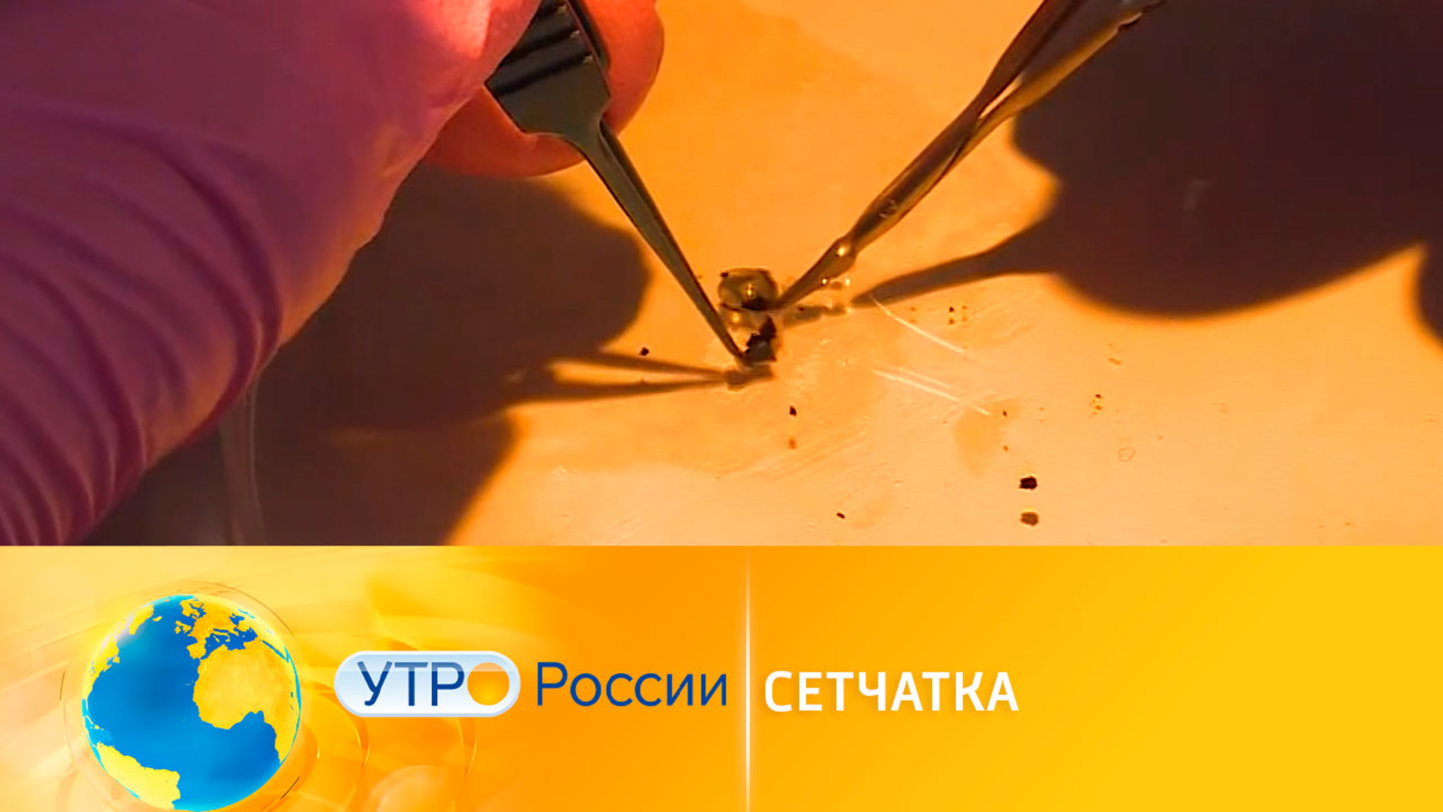 Российские ученый работают над искусственной сетчаткой