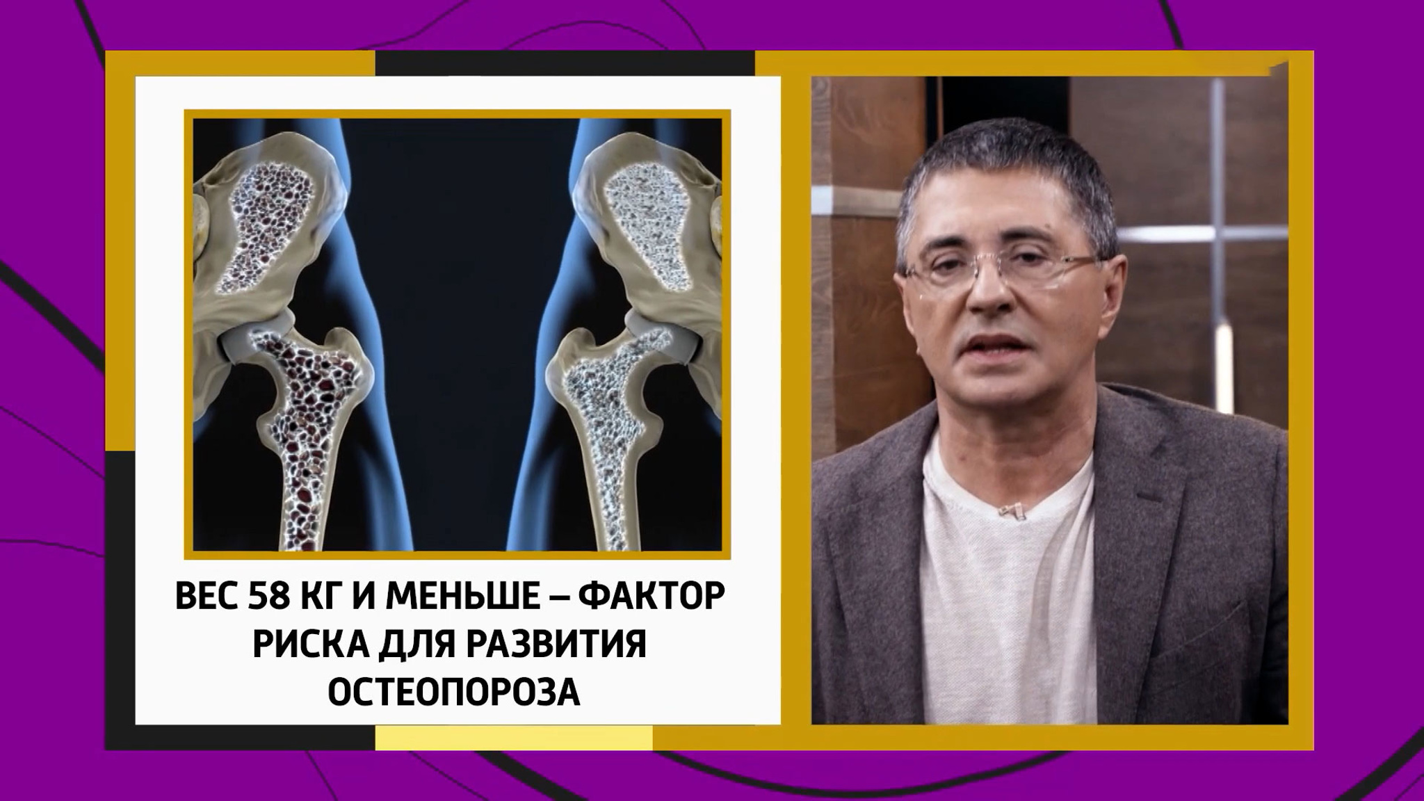 "Тихий убийца", или три простые истины об остеопорозе