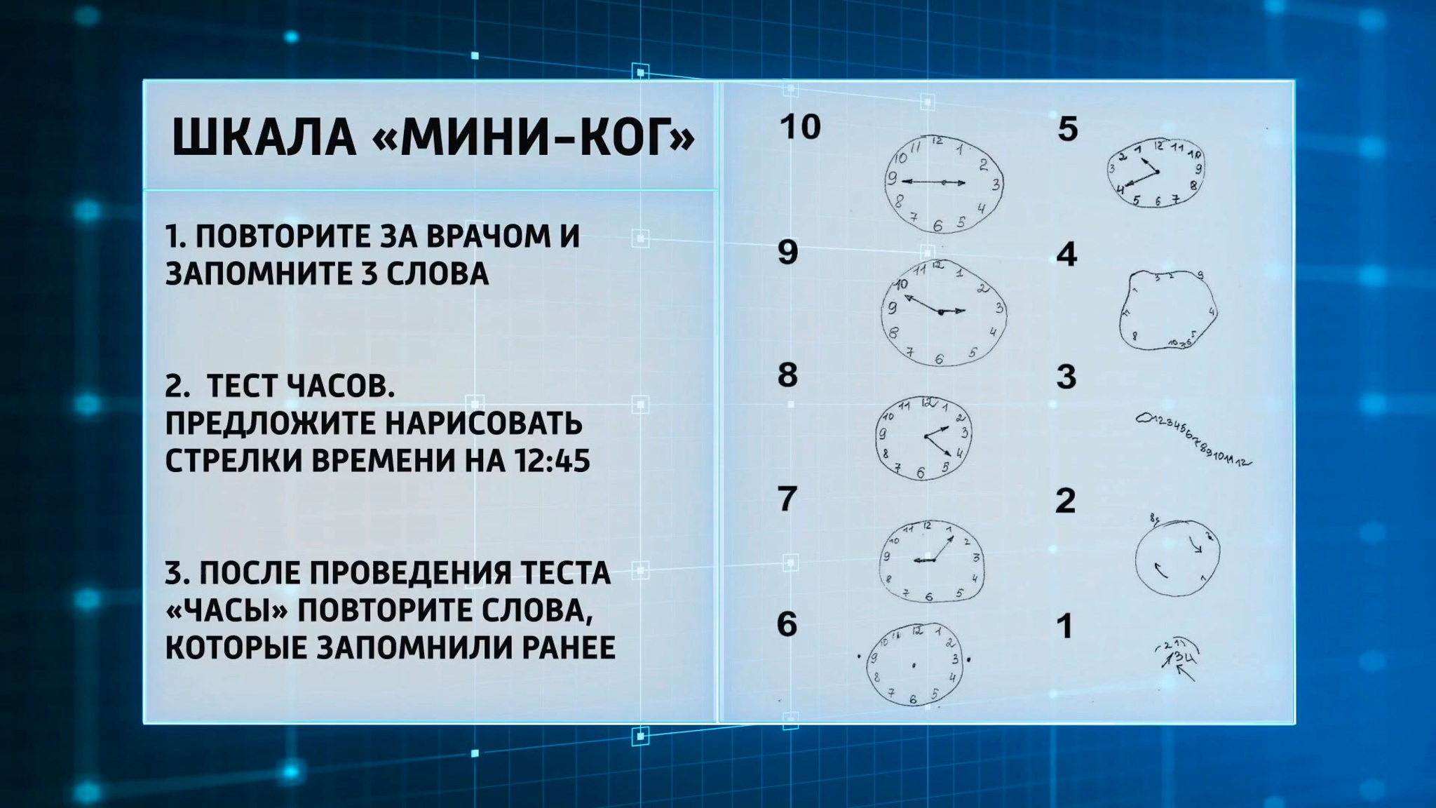 Ухудшение памяти после COVID-19: эффективные способы улучшить работу мозга
