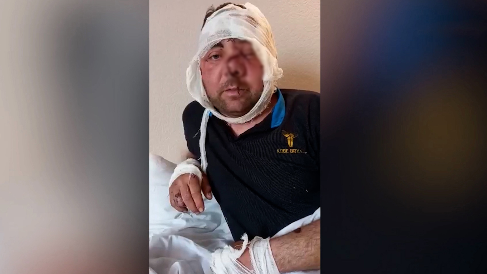 Жуткие травмы: житель Башкирии записал видео после нападения медведя