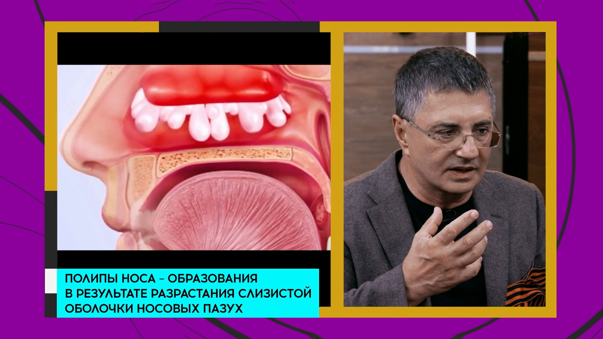 Этот враг не переходит в рак: что не стоит удалять