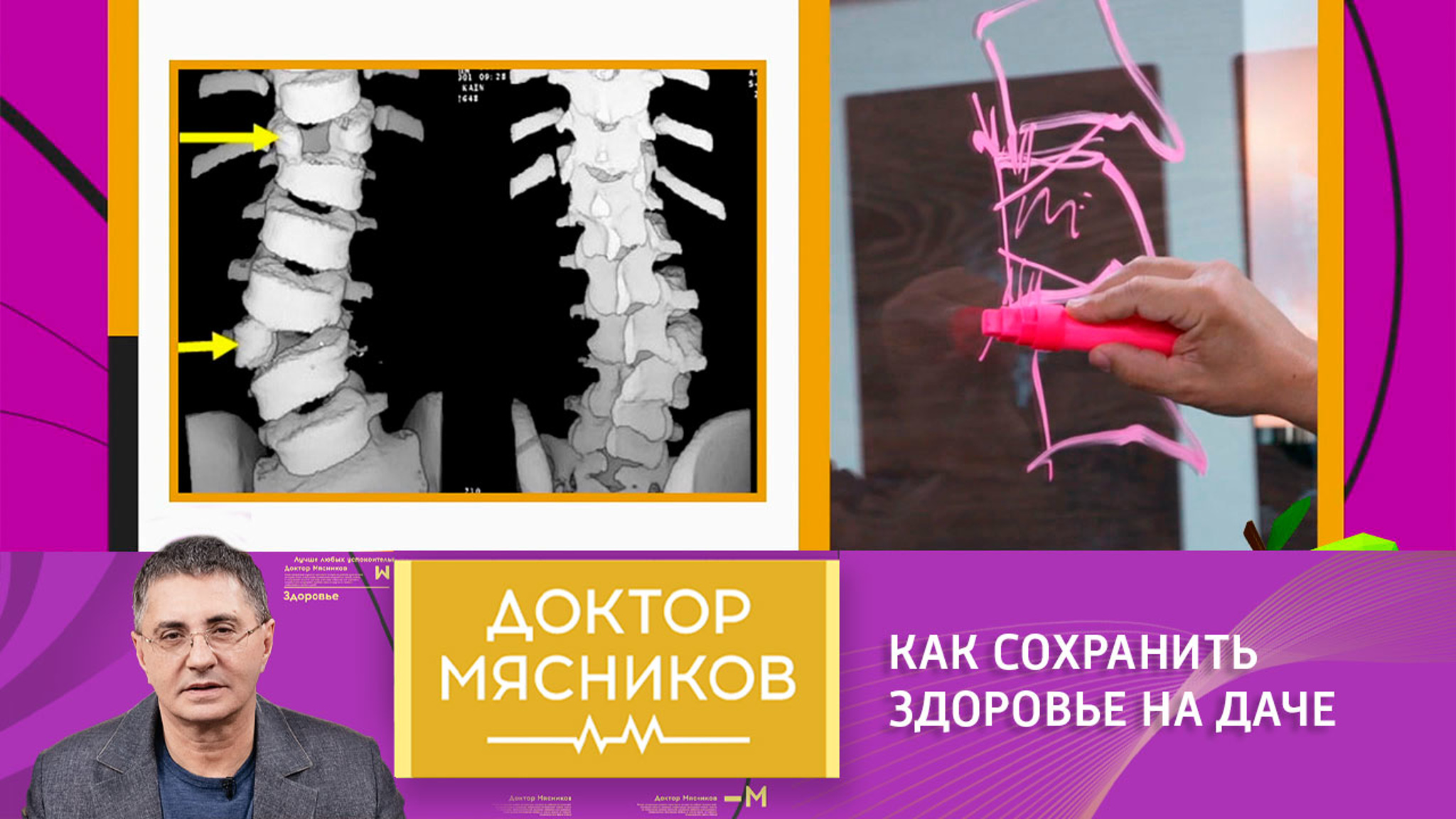 Как сохранить здоровье на даче: советы доктора Мясникова