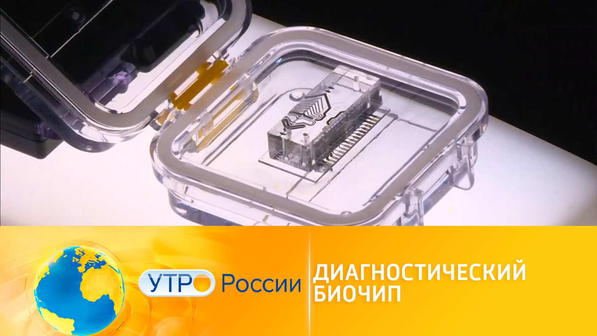 Биочип: новый метод диагностирования заболеваний