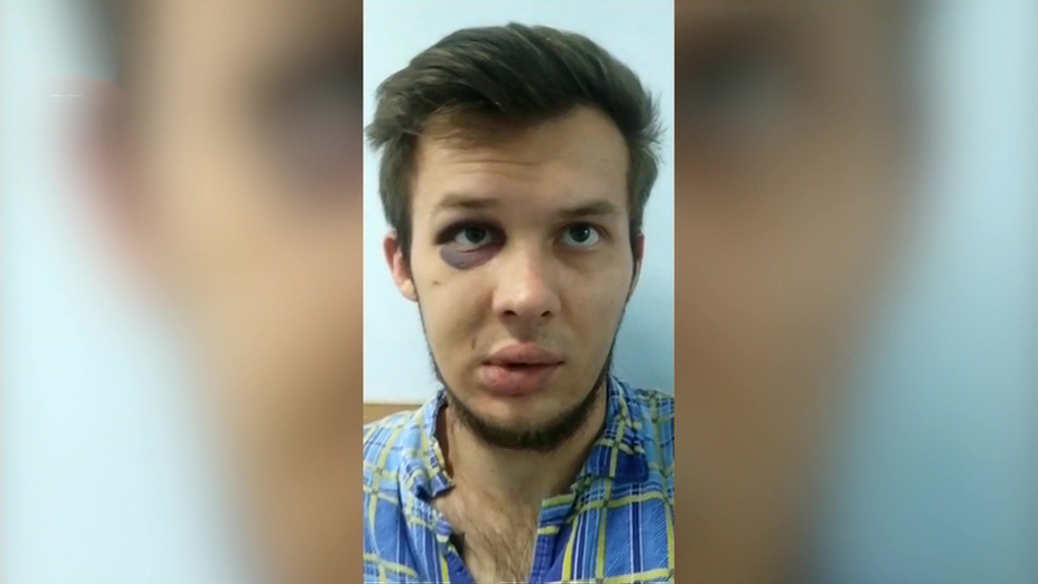 Бойца смешанных единоборств, сильно избившего москвича, не стали арестовывать