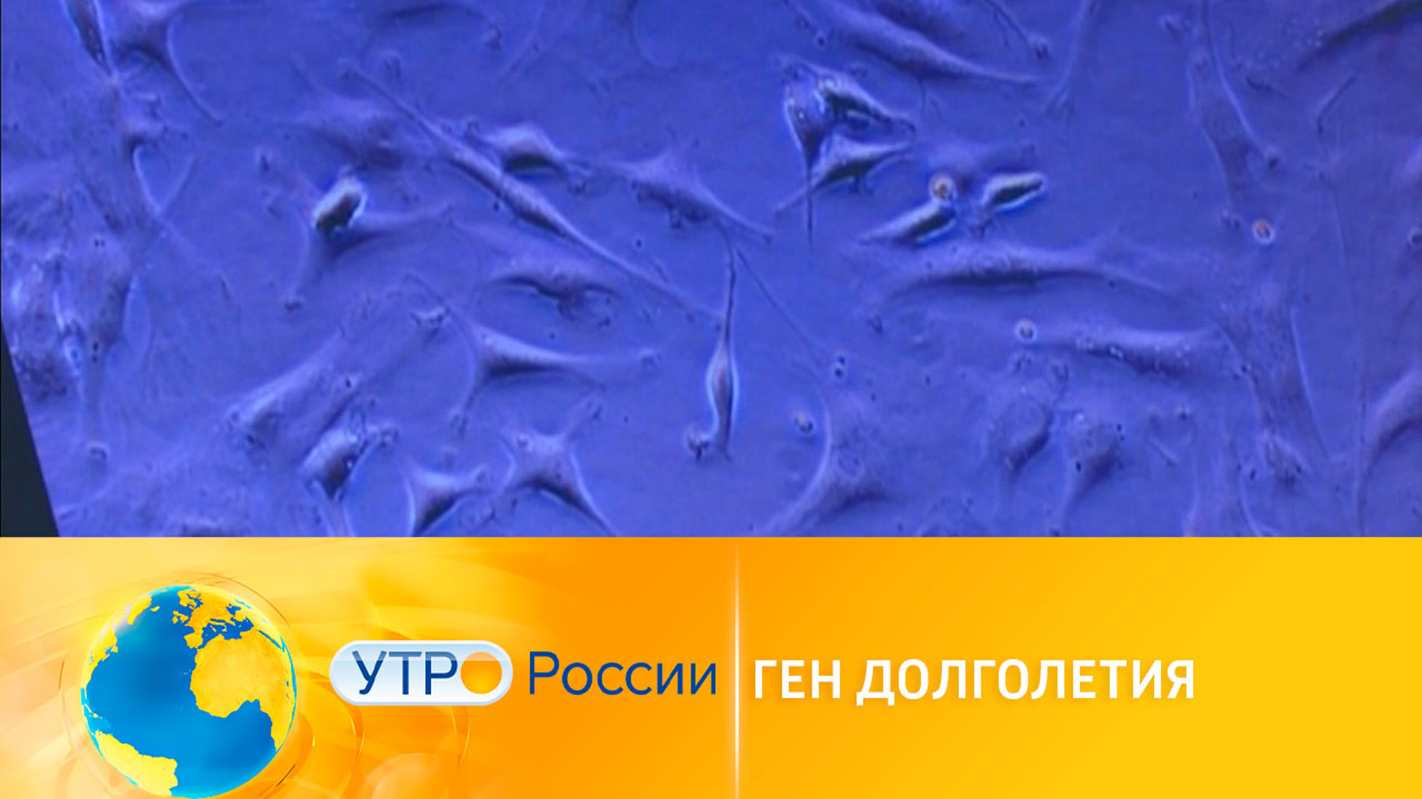 Ученые нашли способ выявлять ген долголетия