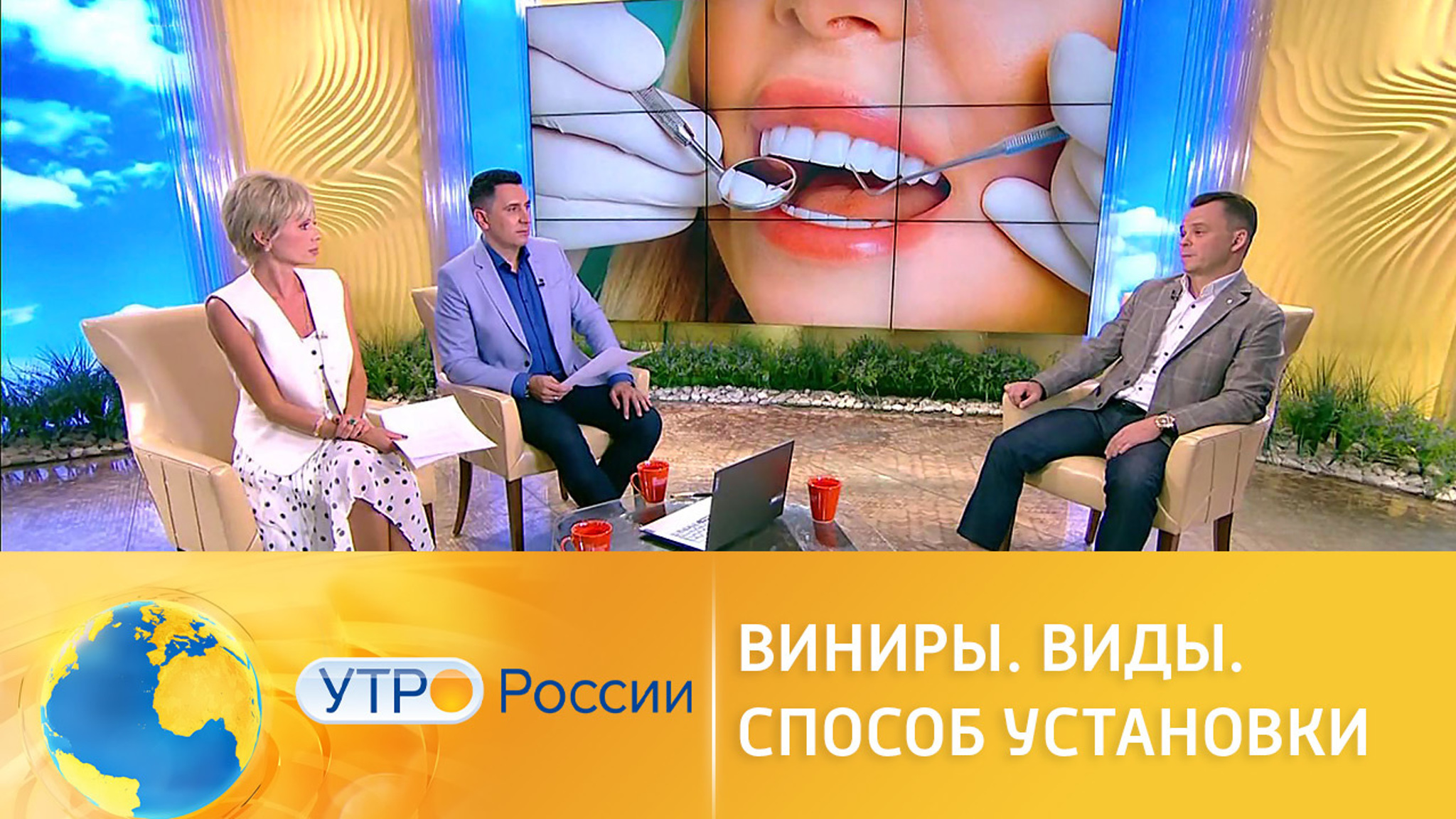 Главное о винирах: виды, установка, плюсы и минусы