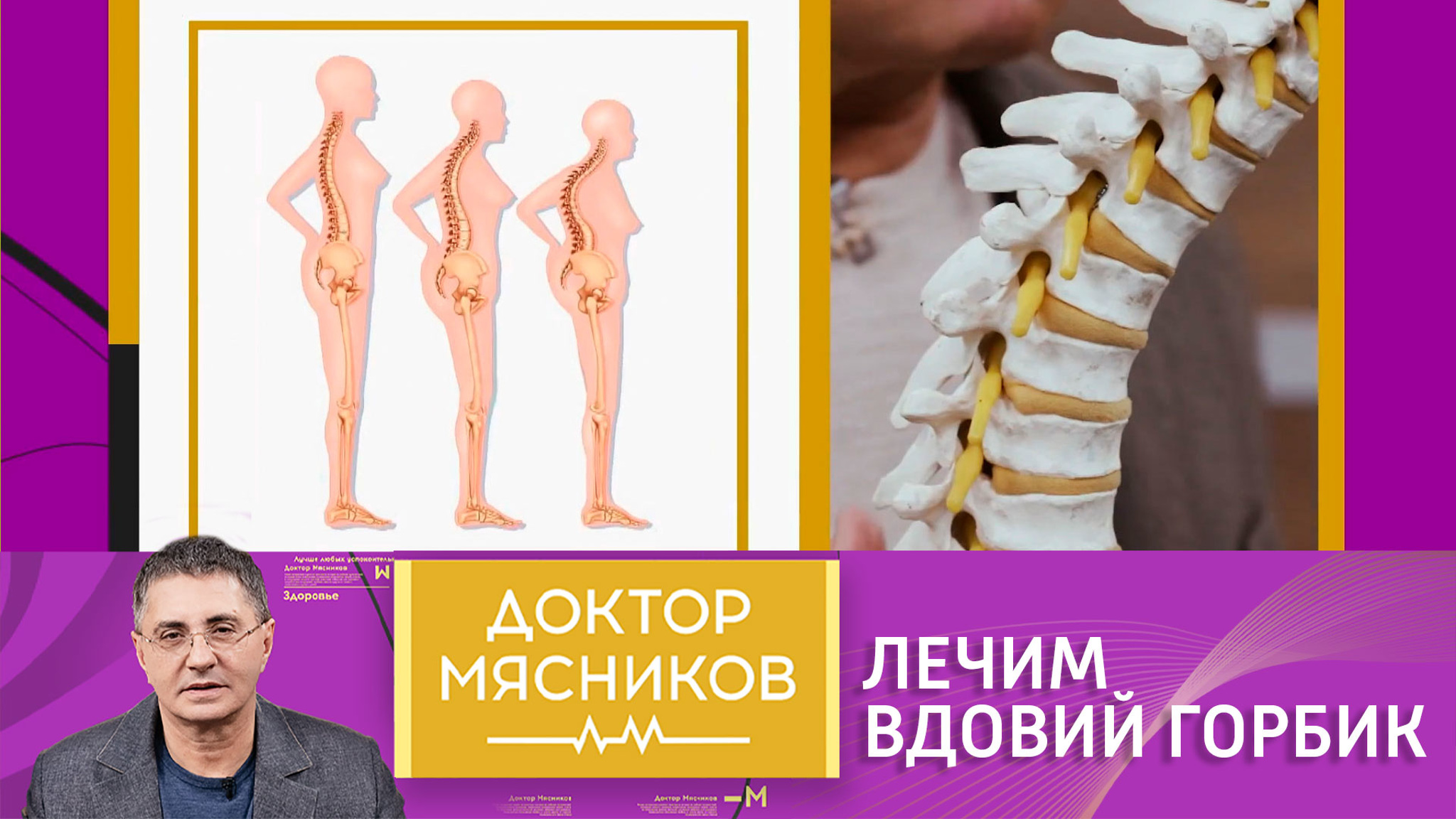 Вдовий горбик: как избежать и чем лечить