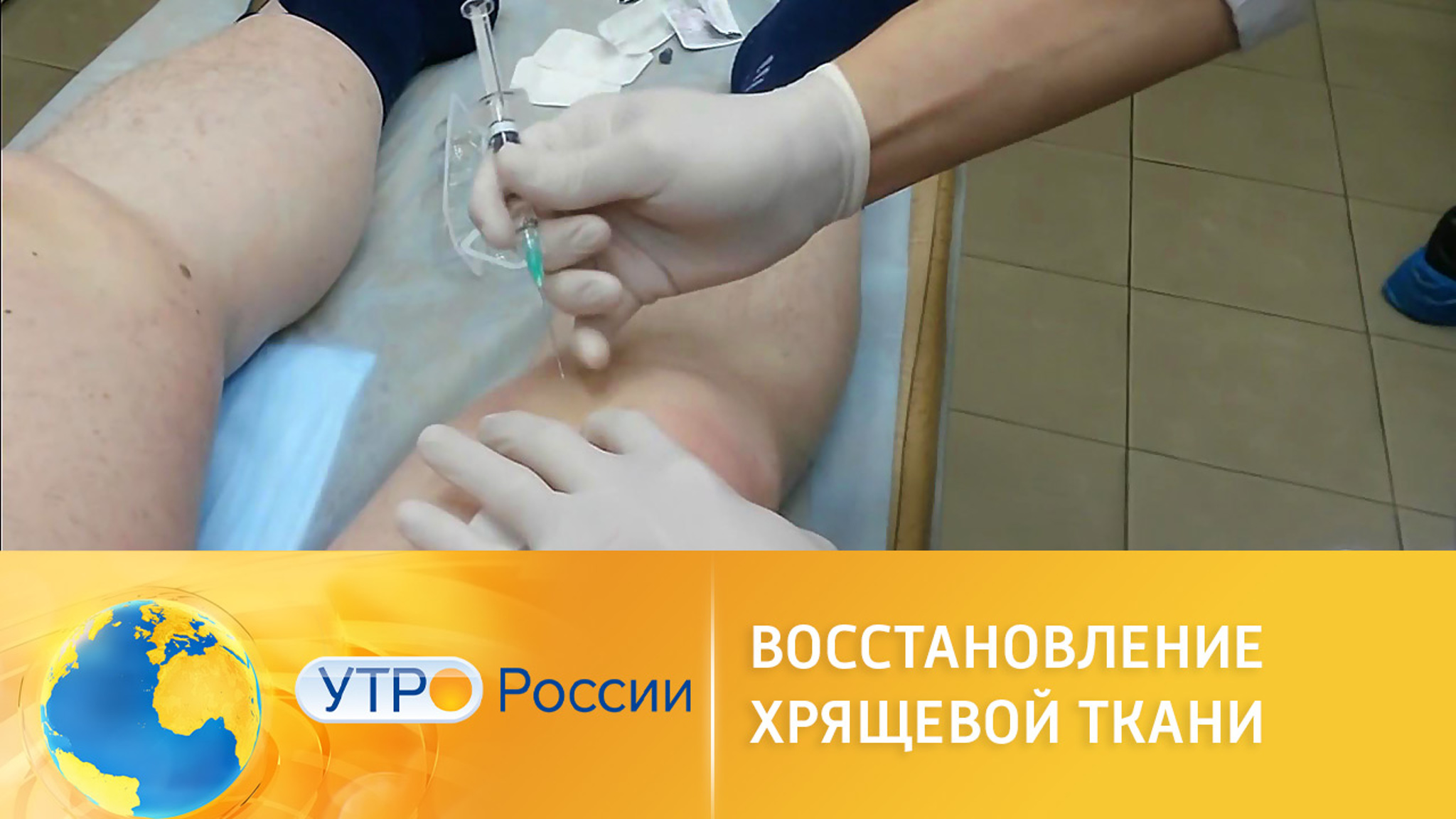 Новые отечественные технологии для лечения артроза
