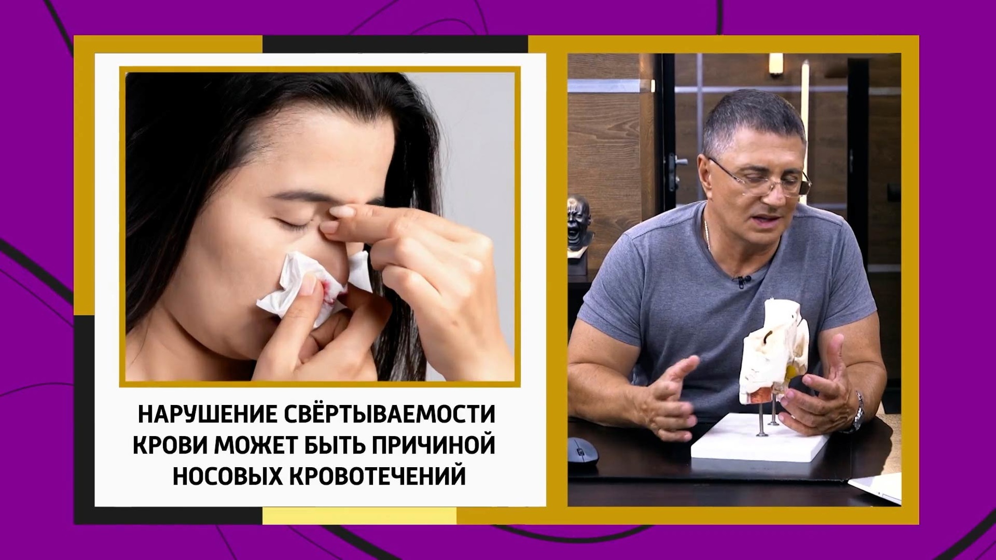 В чем причина частых кровотечений из носа
