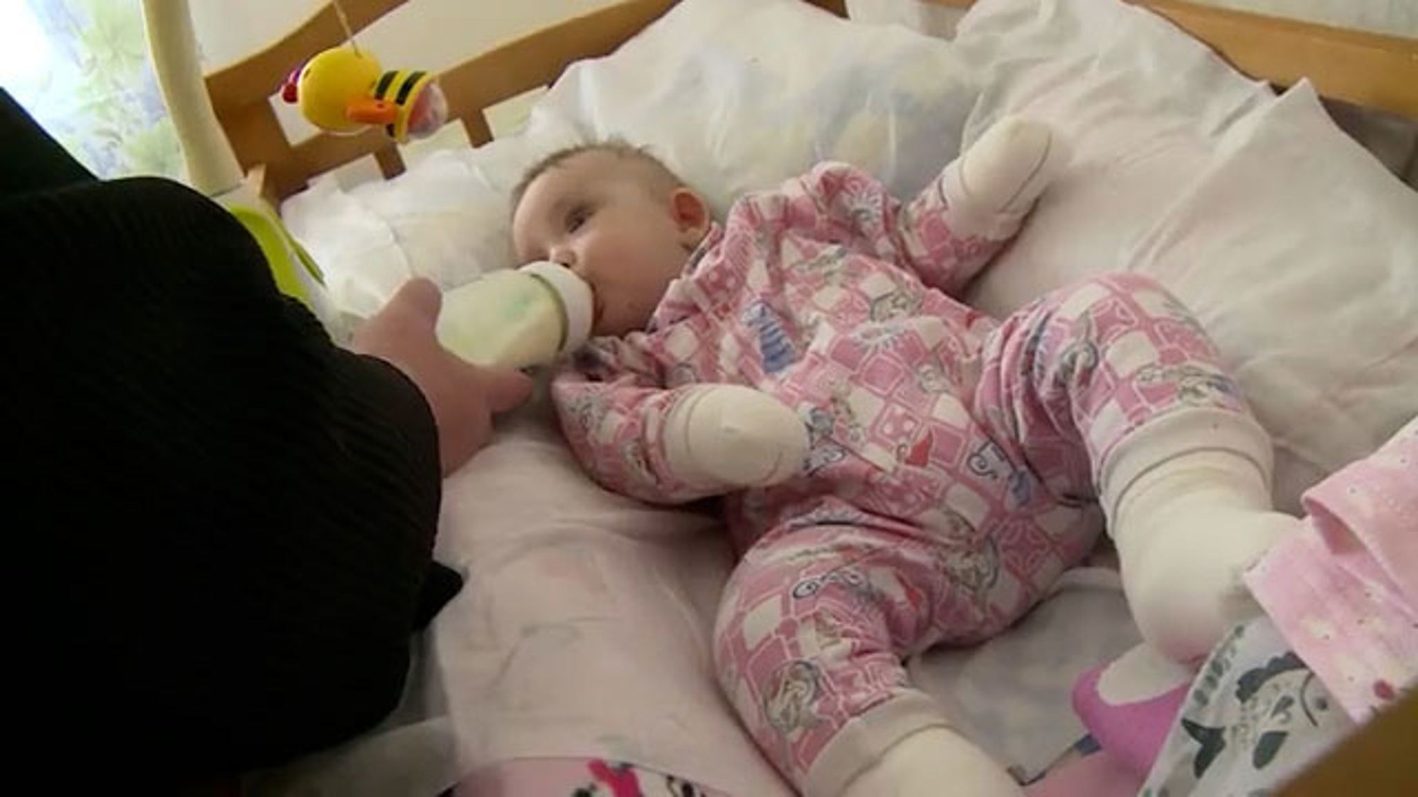 На Алтае девочка с редким заболеванием обрела семью