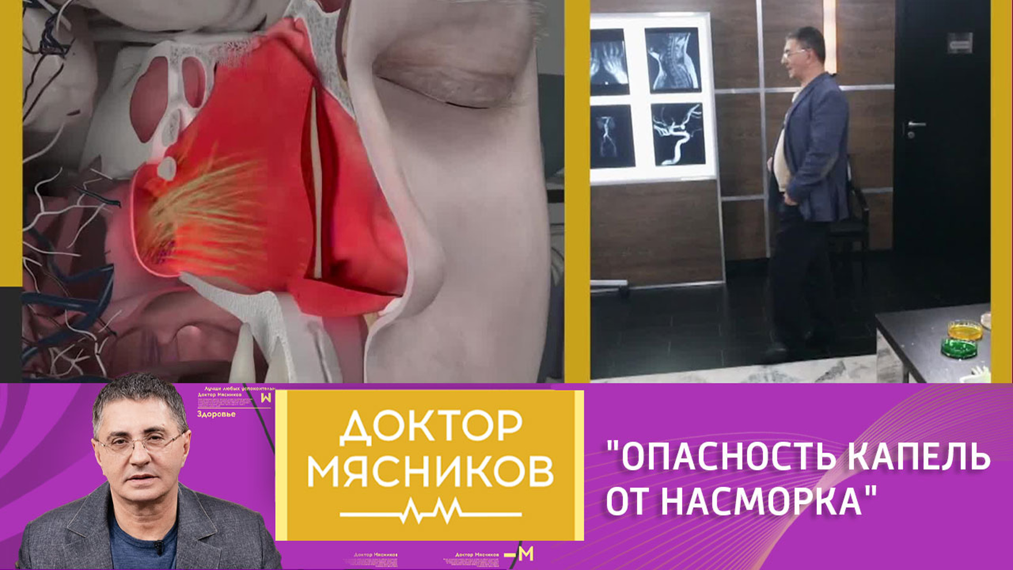 Мясников рассказал, как не надо лечить насморк