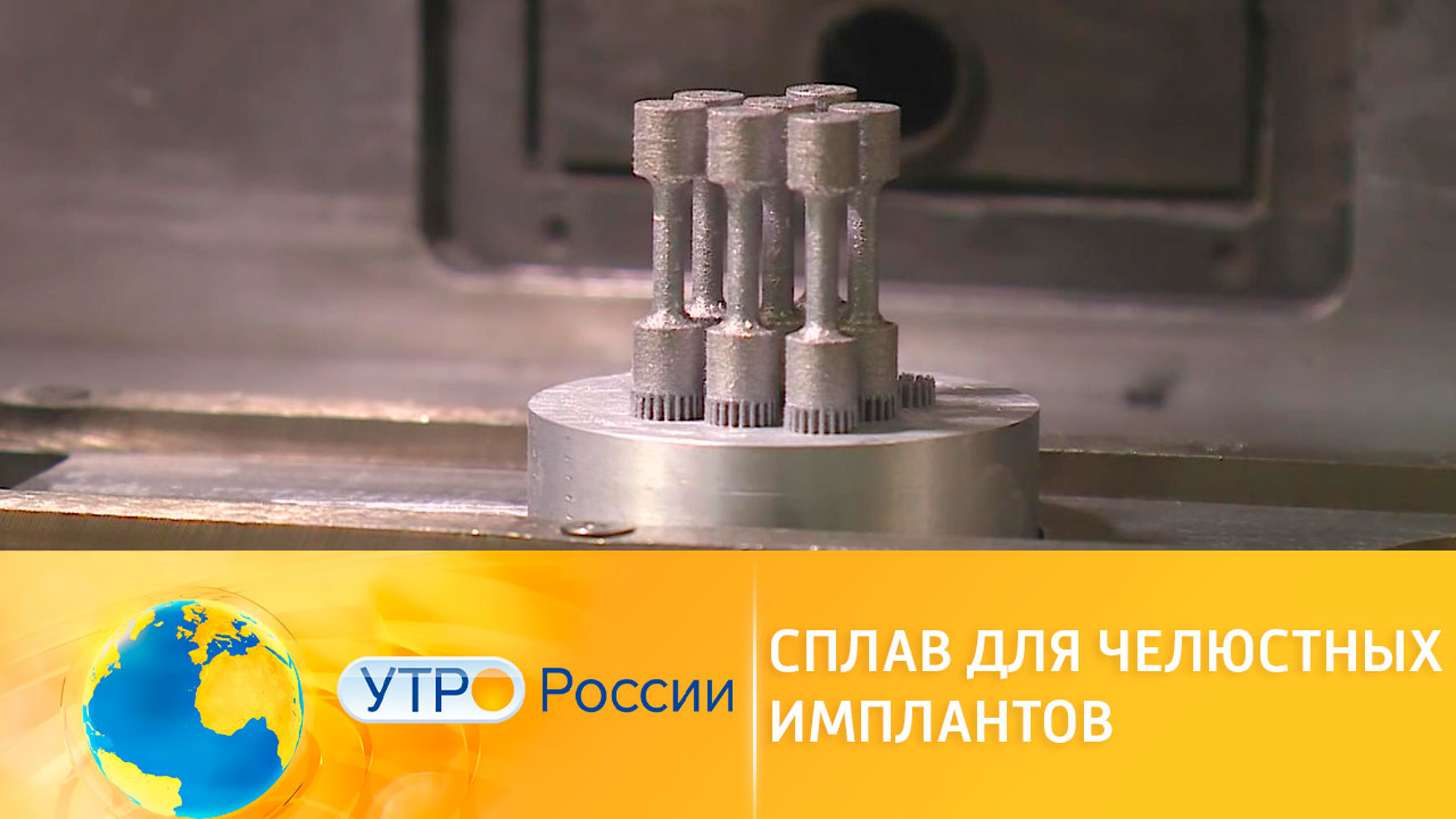 В России разрабатывают новые материалы для челюстных имплантов