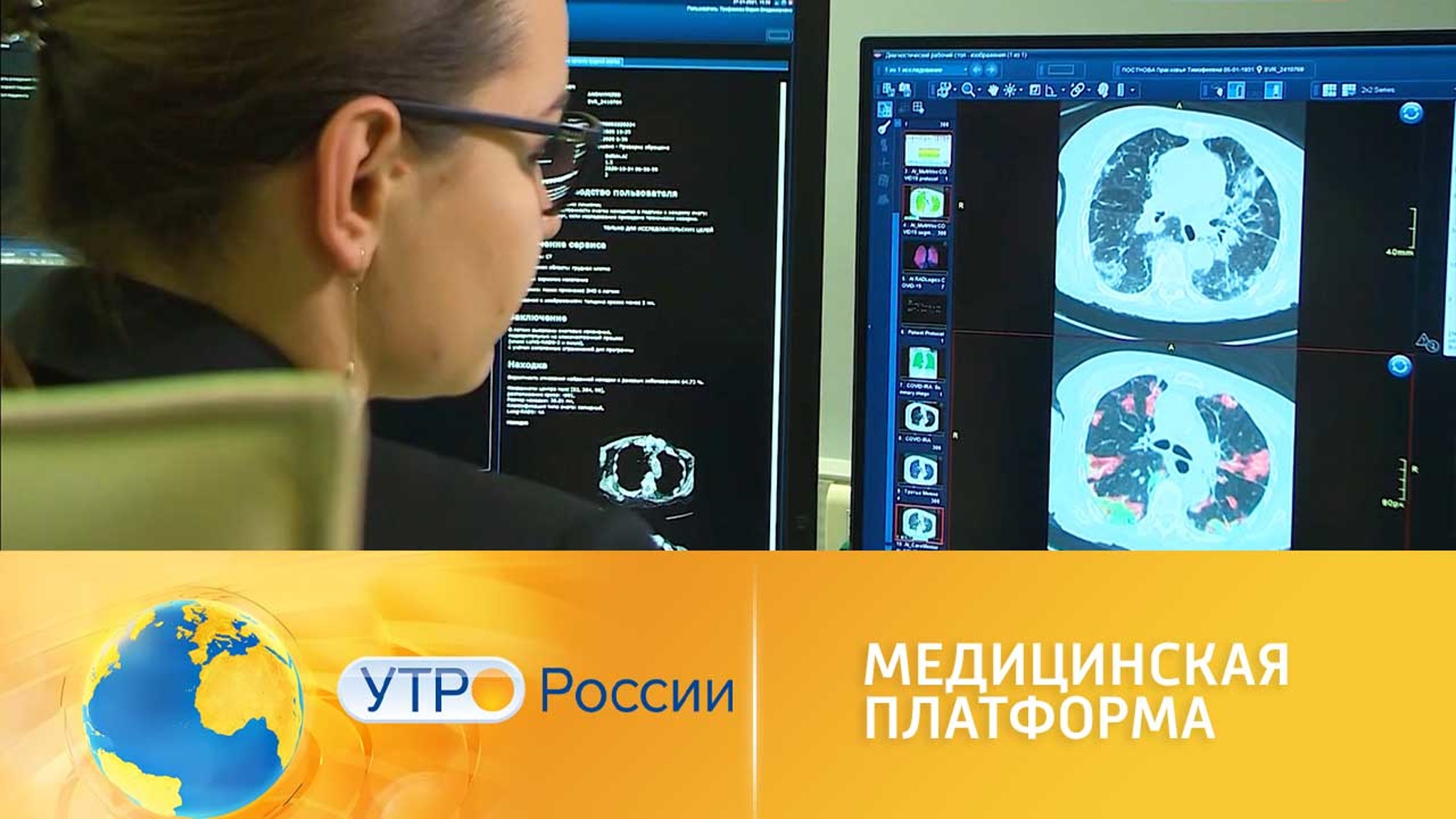 Искусственный интеллект помогает поставить диагноз