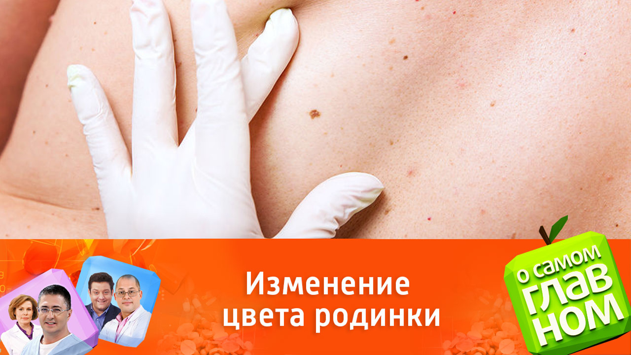 Родинка меняет цвет: опасно ли это
