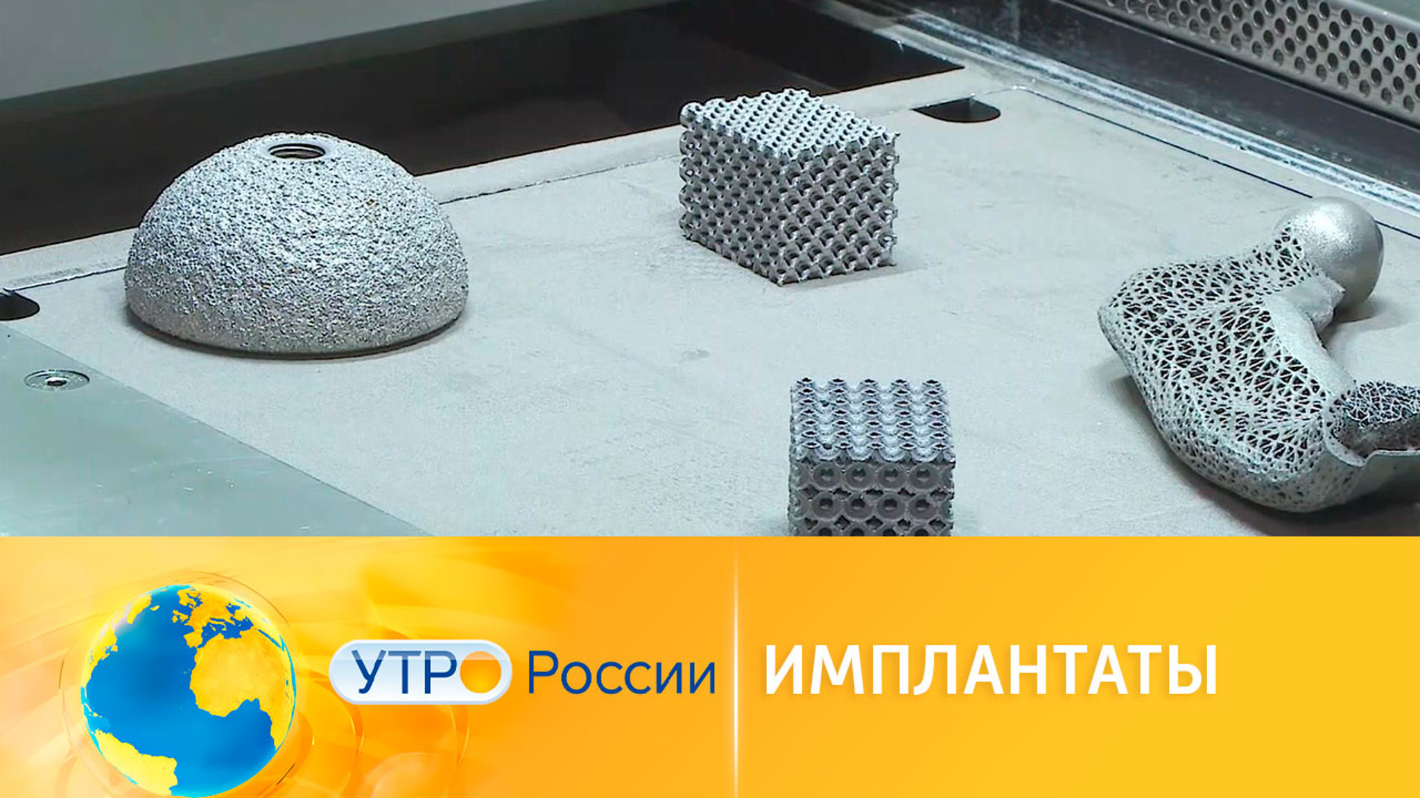 Ученые разработают имплантаты для лечения патологий костной ткани