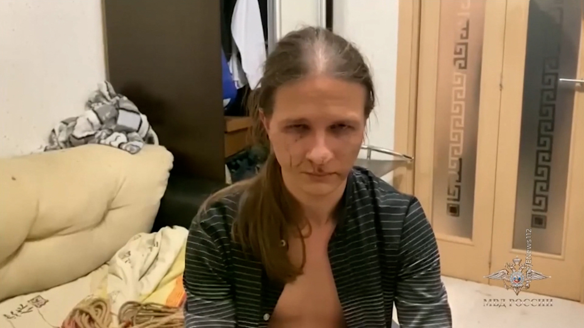 Мужчина, обливший в Домодедове молодую пару кислотой, сделал это из ревности