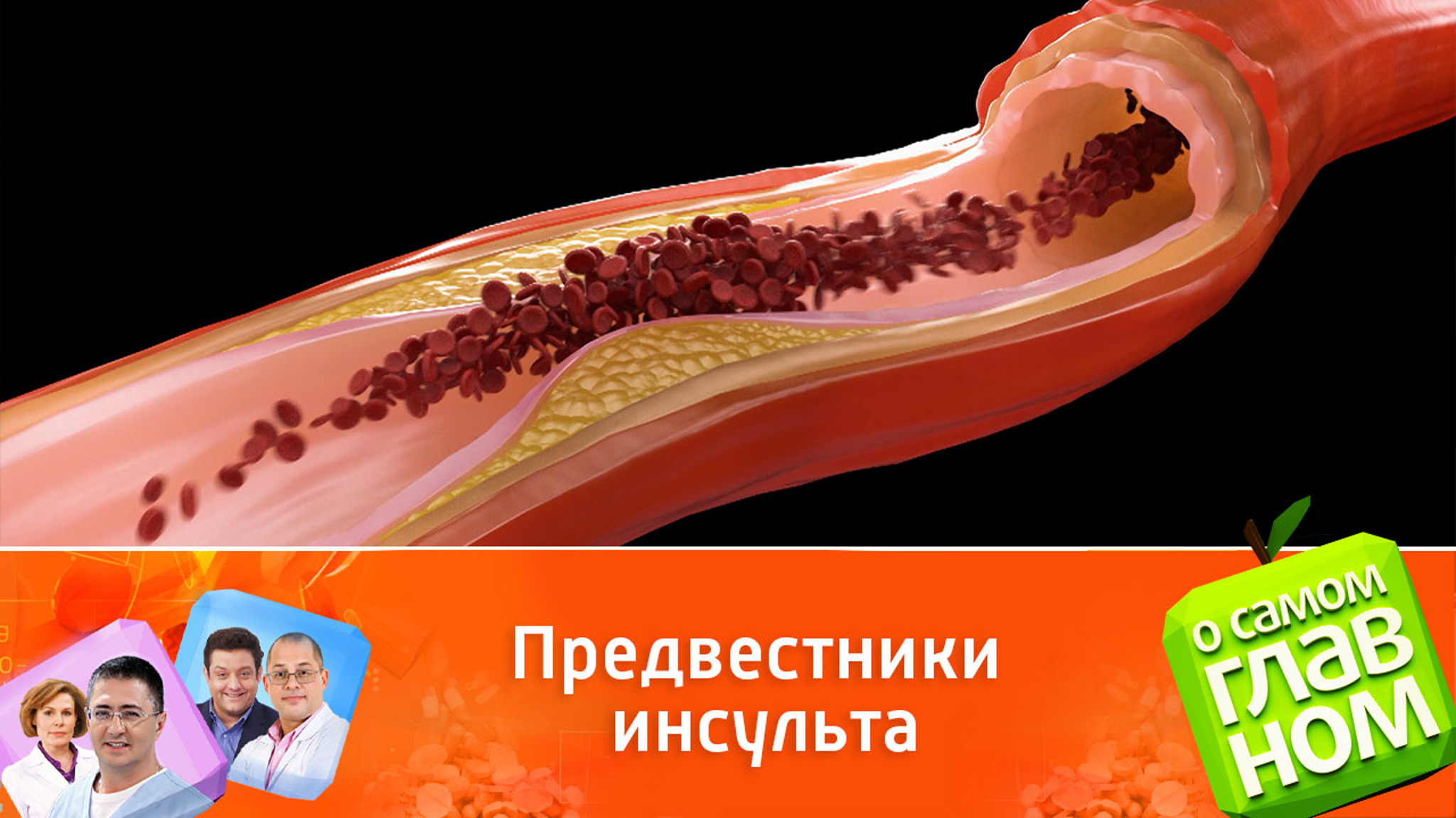 О чем сигнализирует сонная артерия