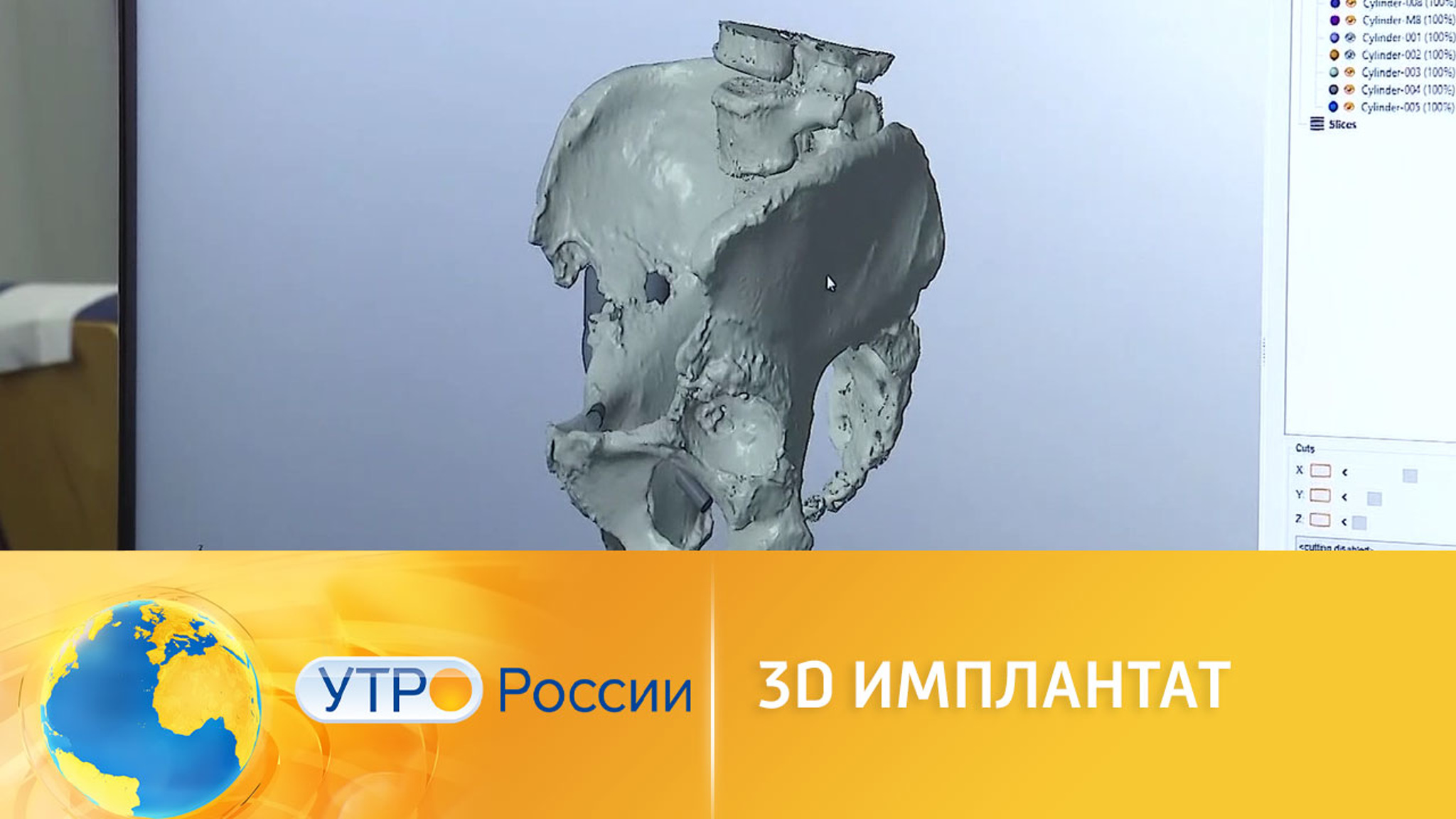 Технологии для лечения патологий костной ткани