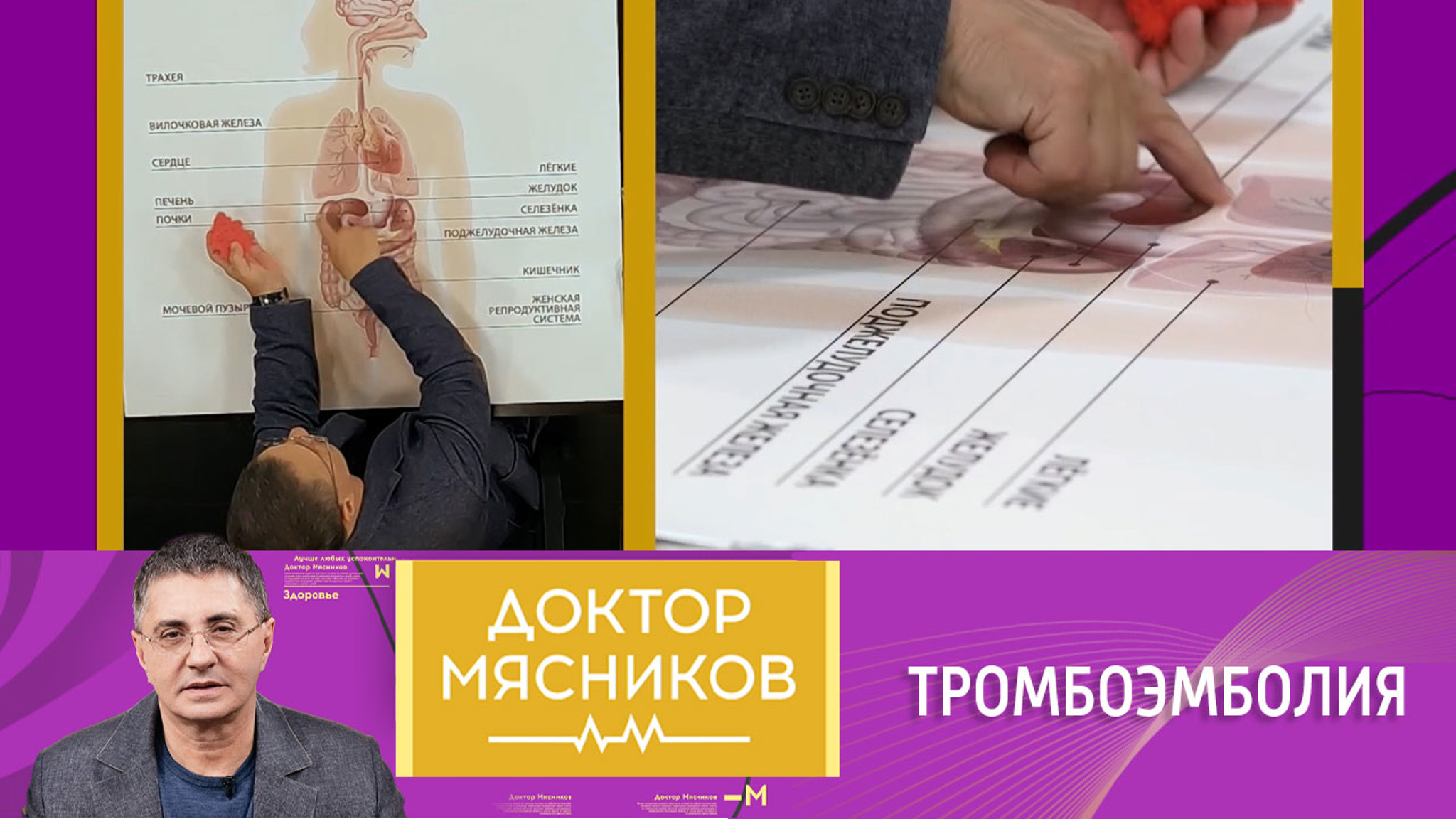 Доктор Мясников назвал первые симптомы тромбоза