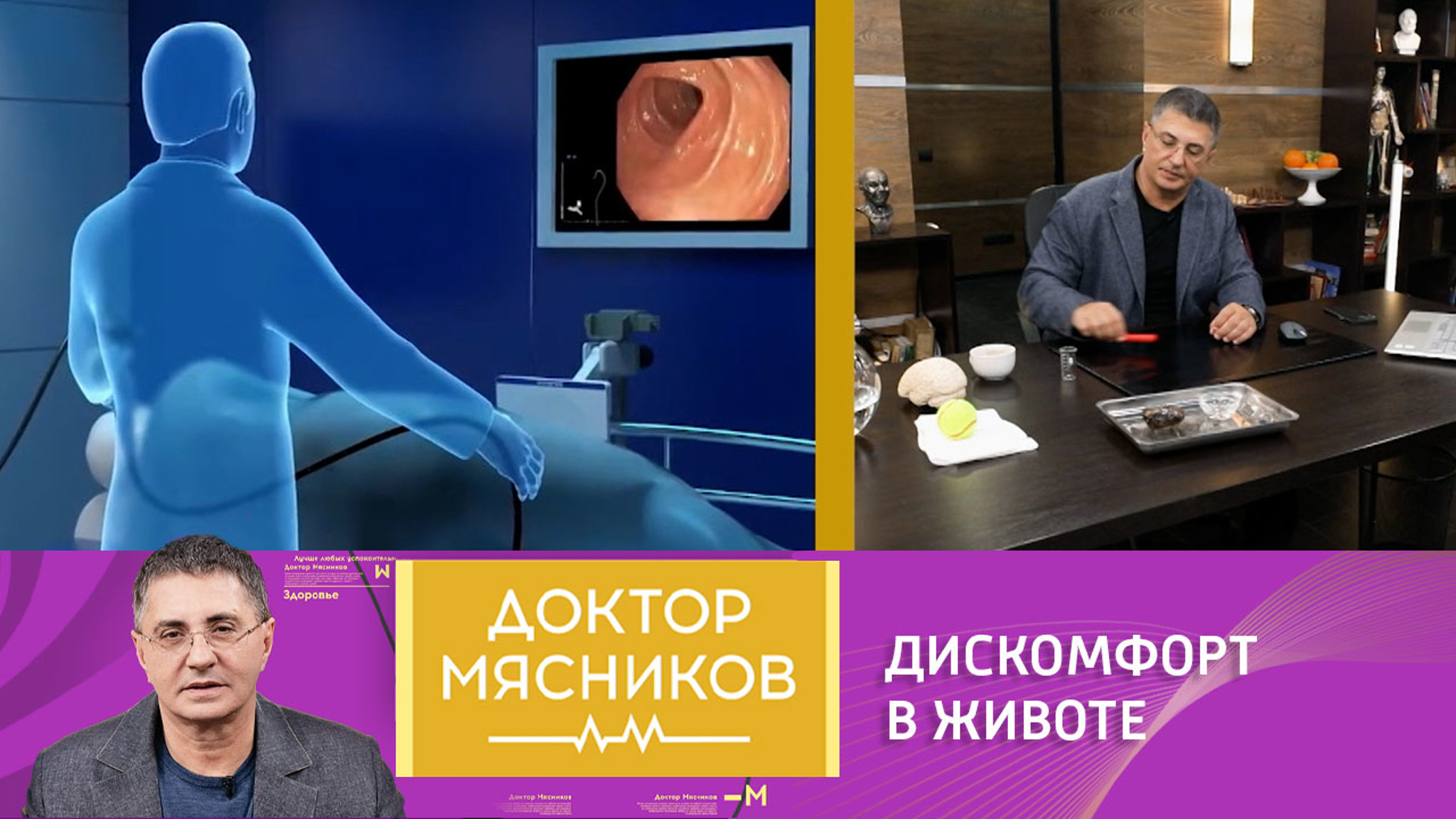 Доктор Мясников рассказал о пользе и вреде спазмолитиков