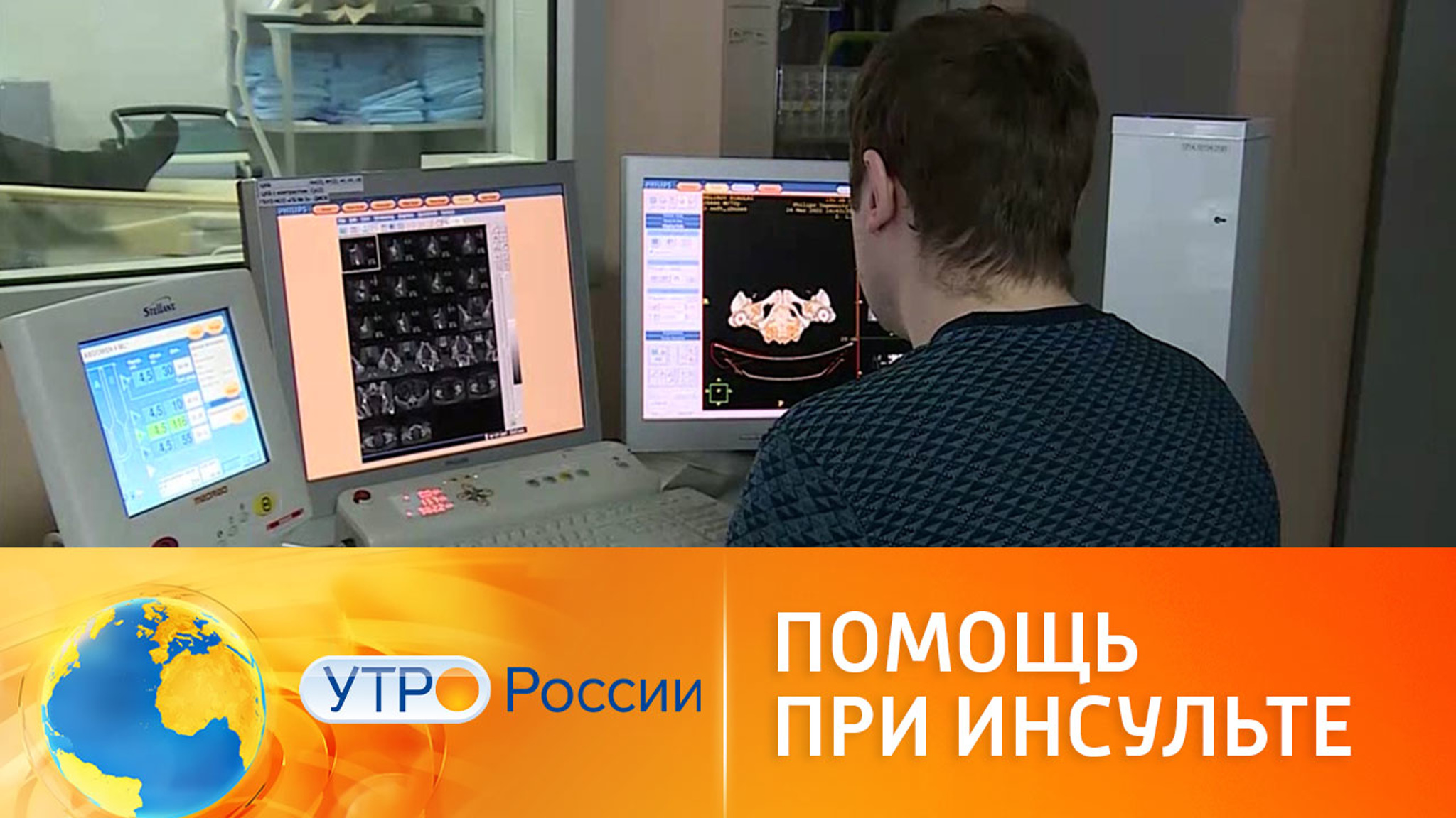 В Новосибирске создали программу для определения типа инсульта