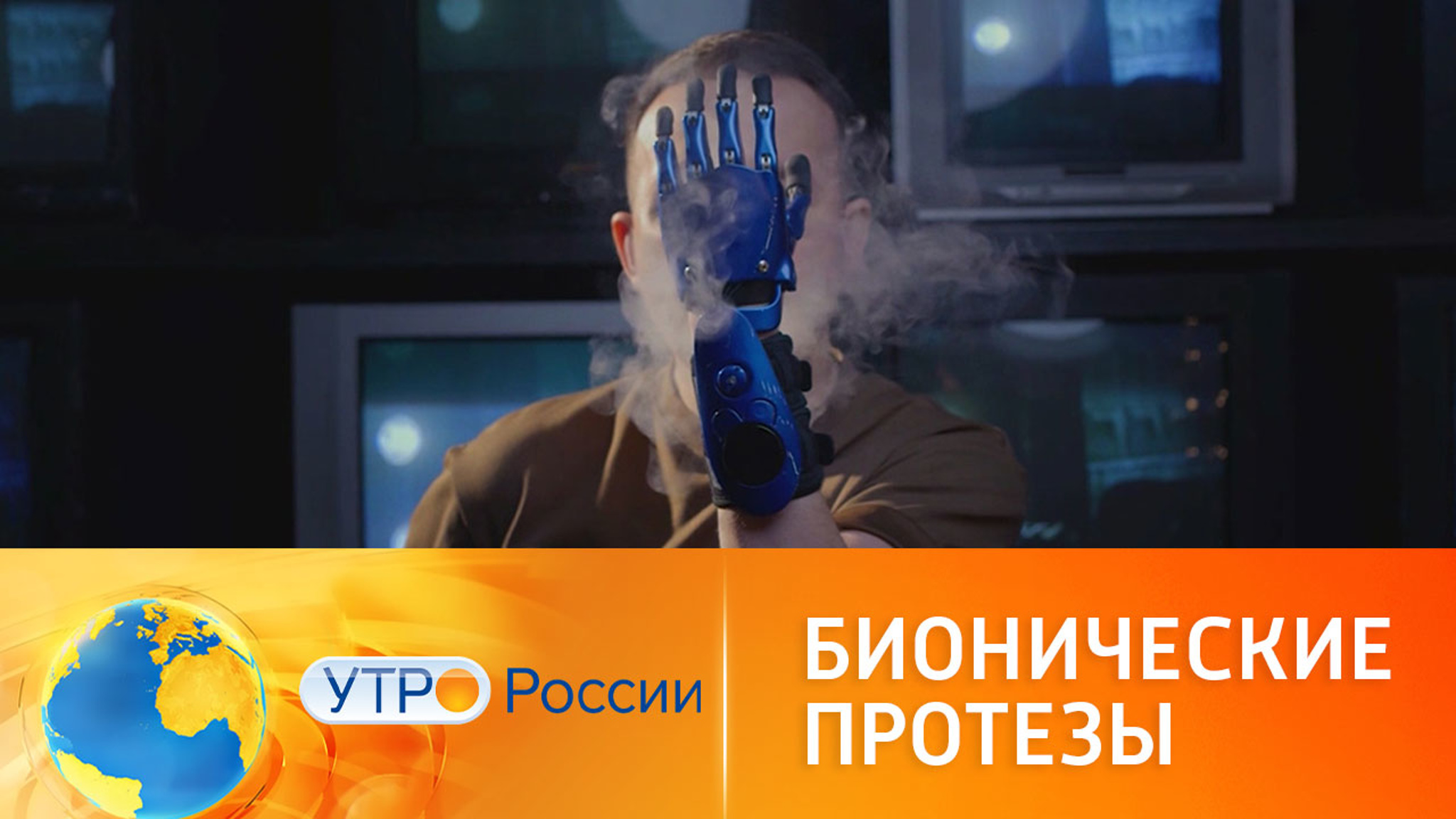 Российские инженеры создают умные бионические протезы