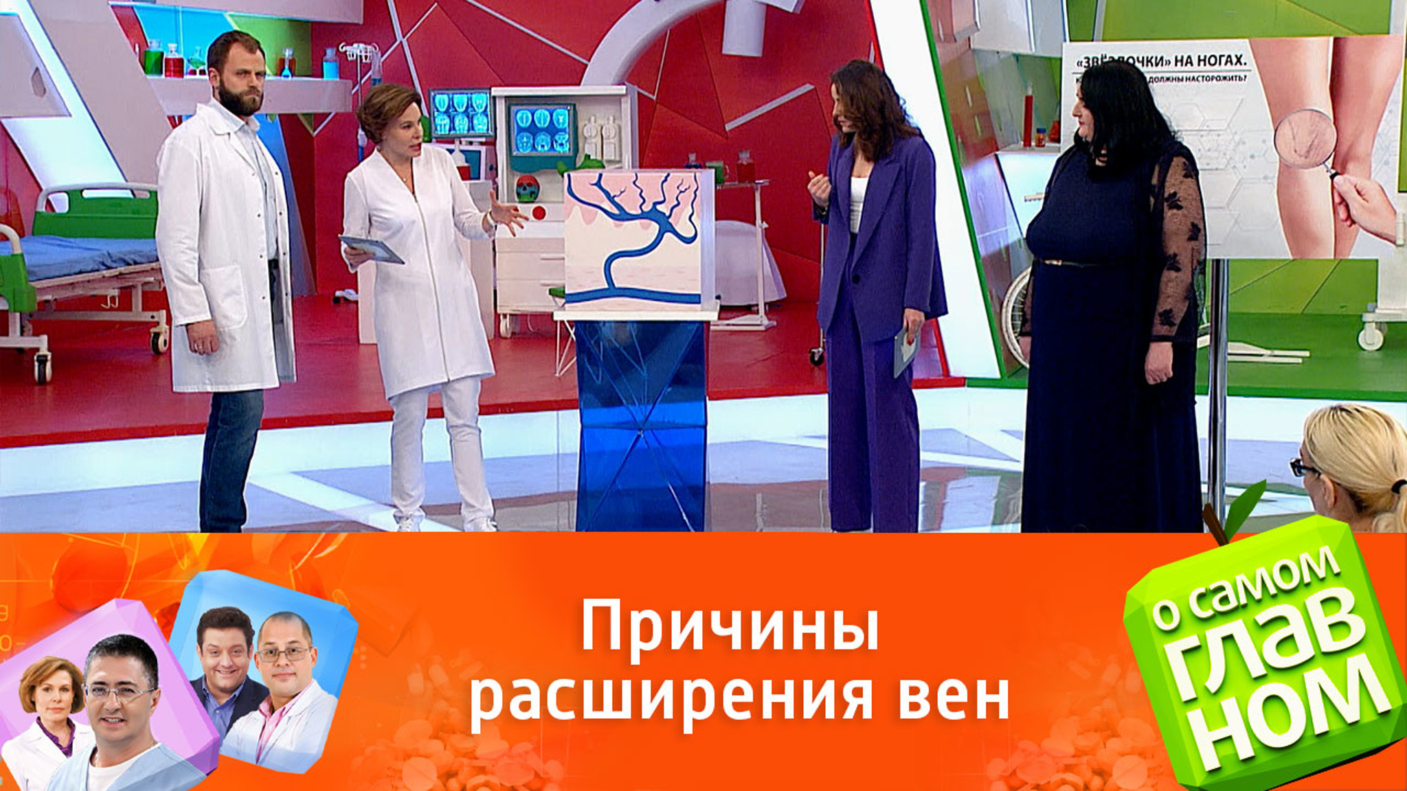 Что делать с сосудистыми звездочками на ногах