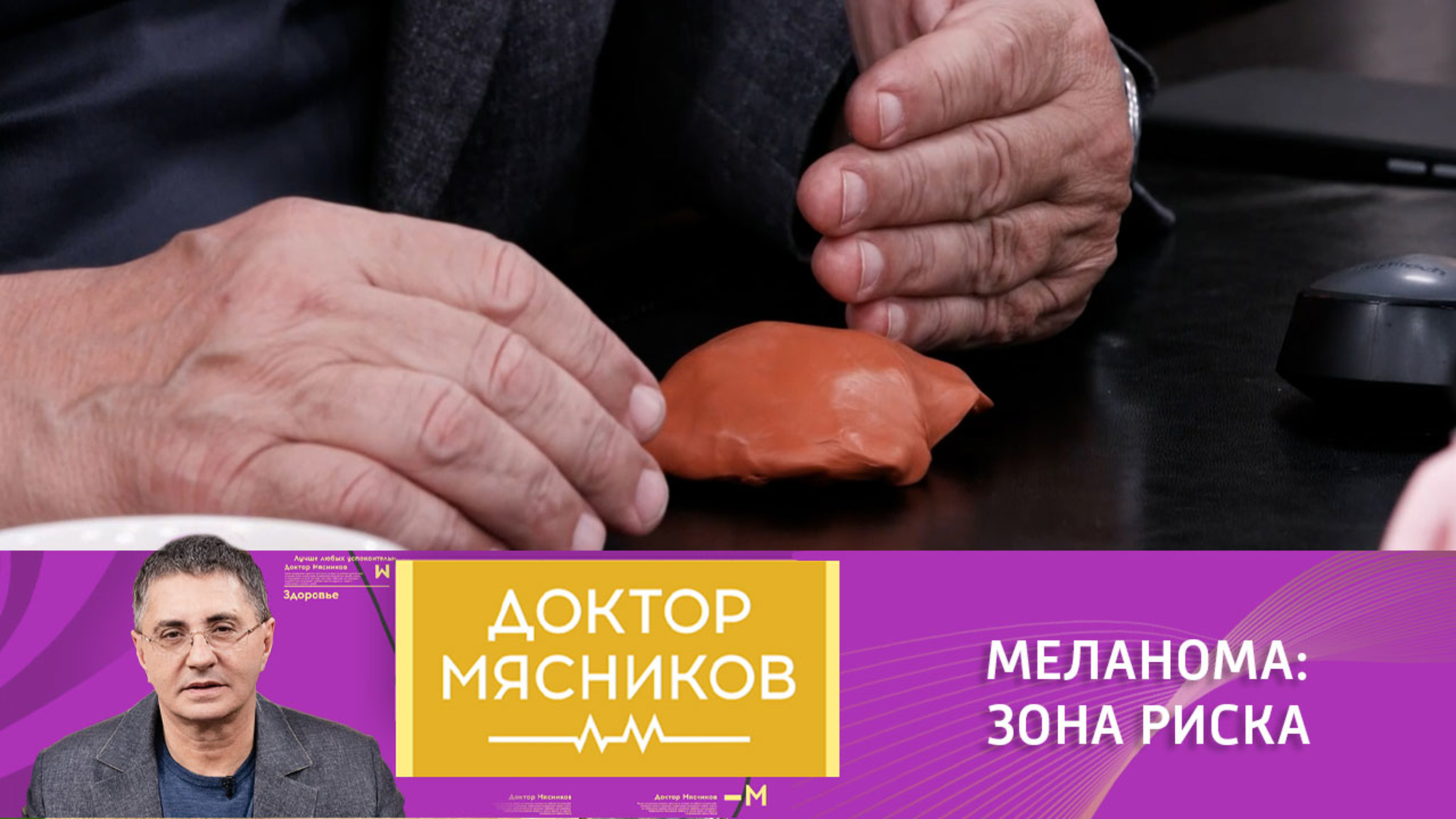 Риск развития меланомы: при чем тут цвет волос