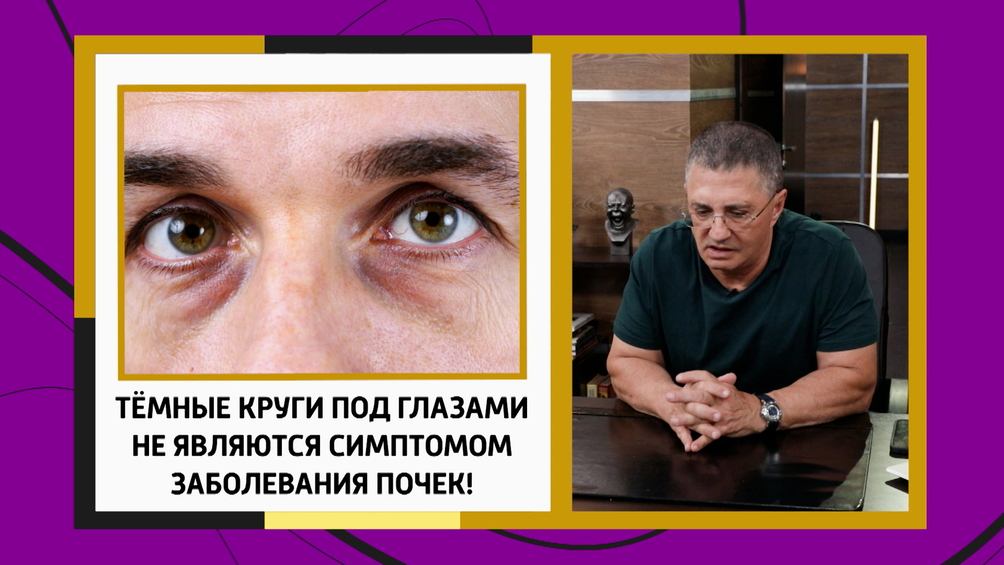 Александр Мясников развеял миф о темных кругах под глазами