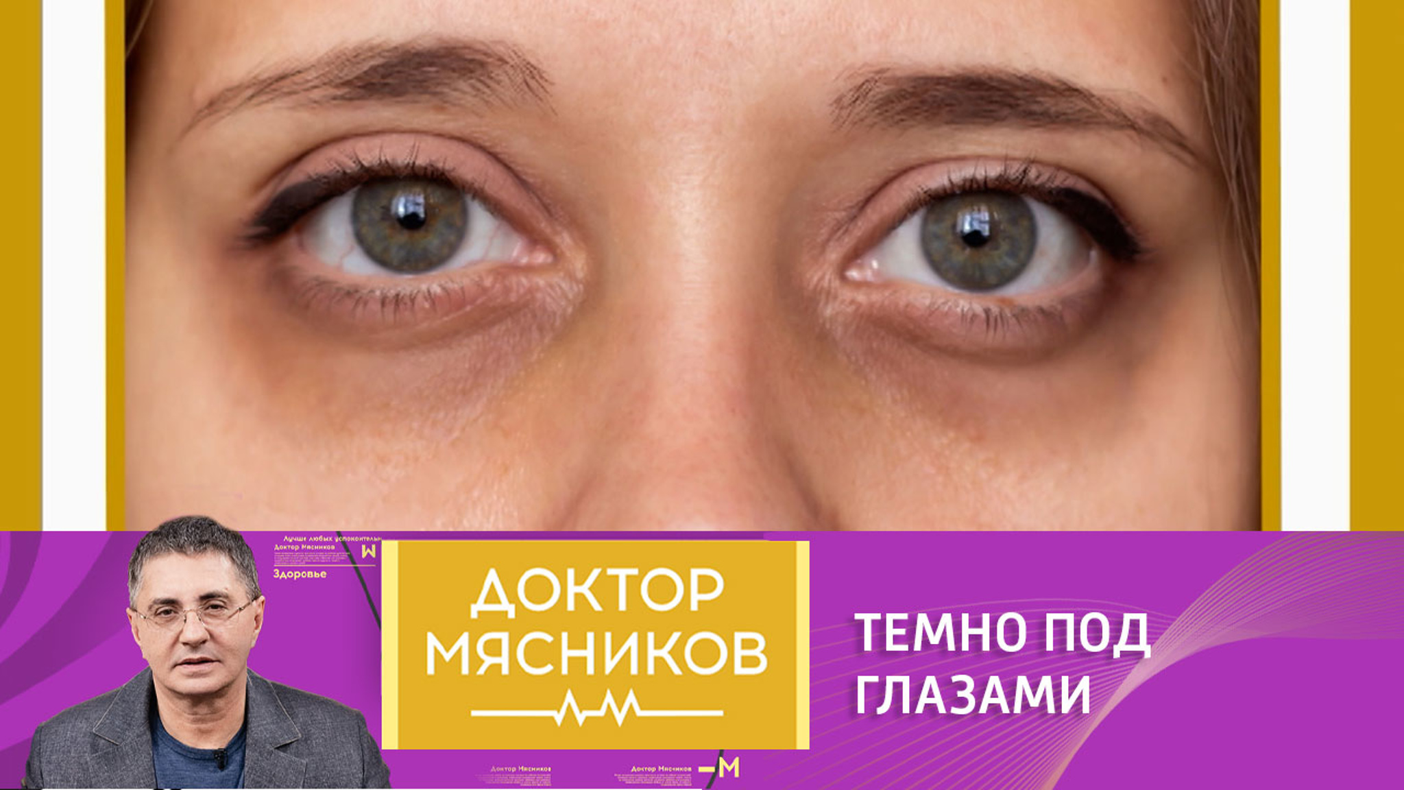Александр Мясников развеял миф о темных кругах под глазами