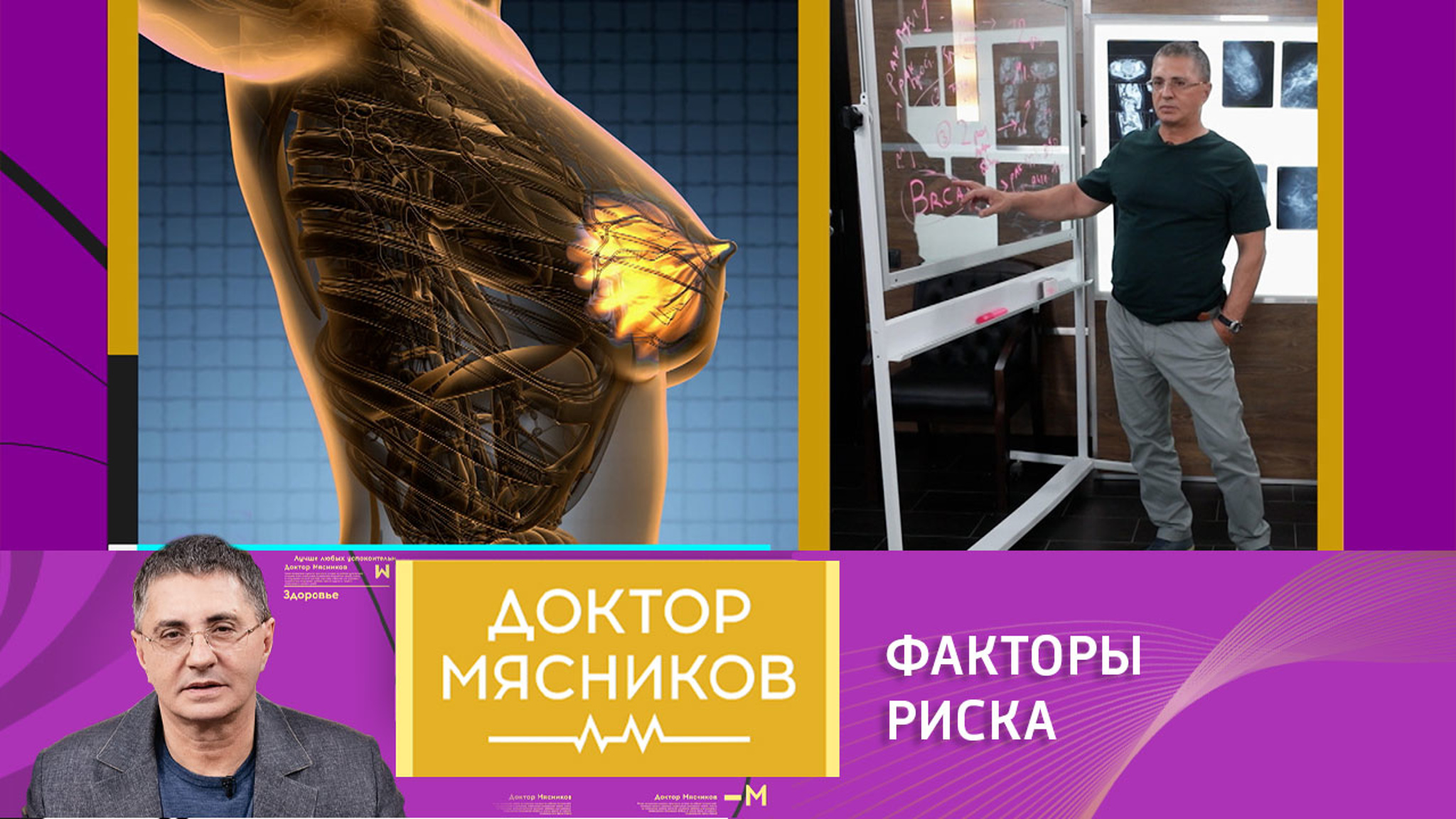 Рак груди: что повышает риск