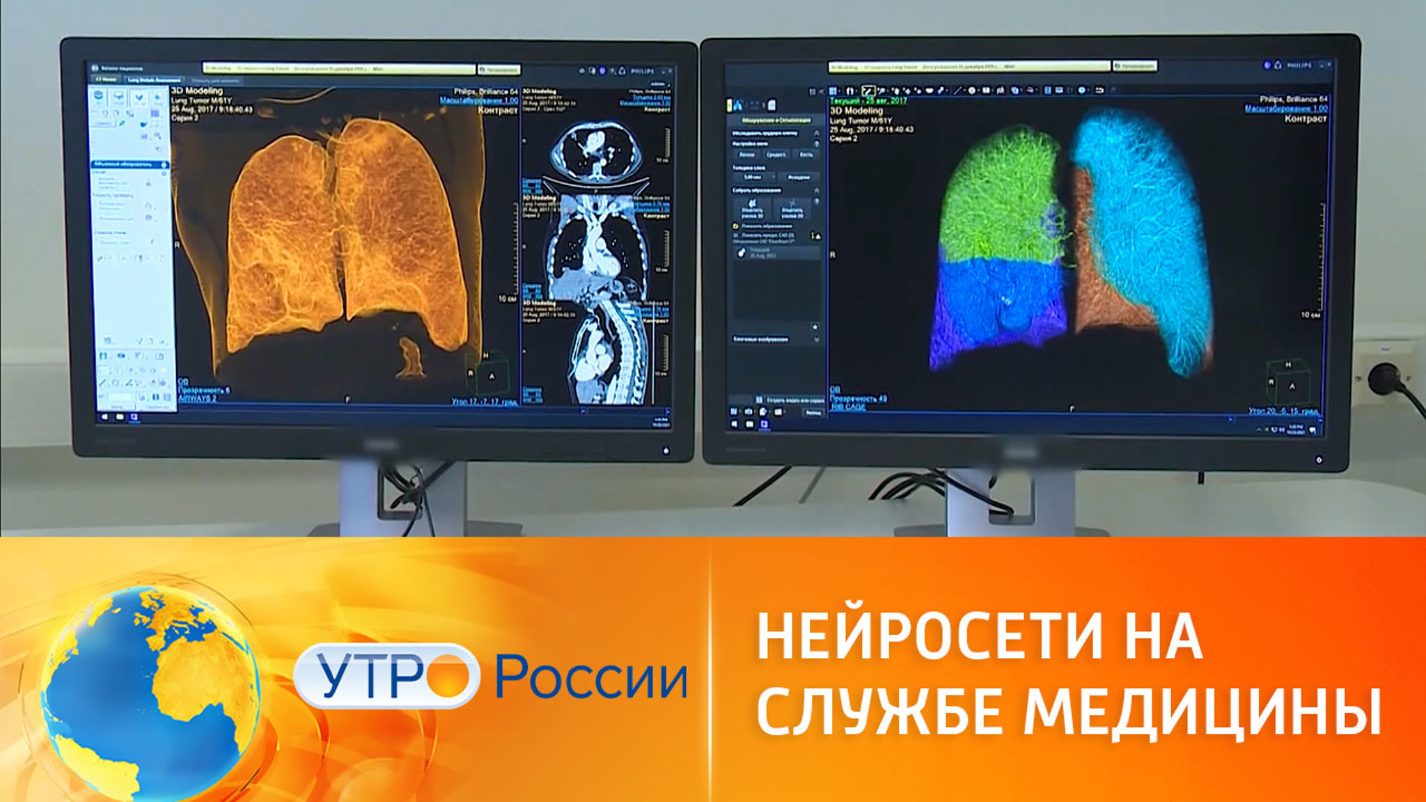 Искусственный интеллект в медицине